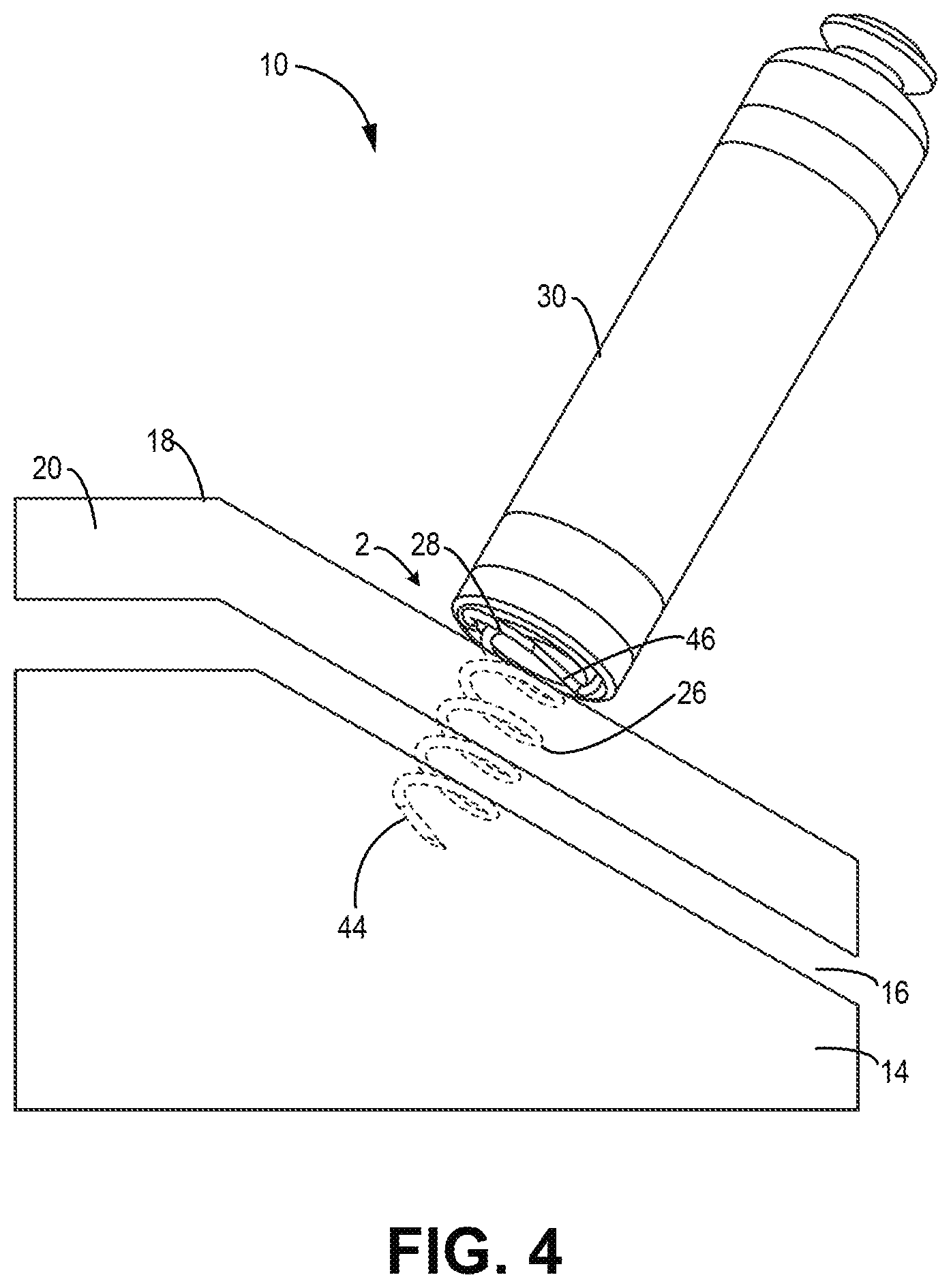 Patent US12303685 Figure 4 – Electrode configuration for a medical device
