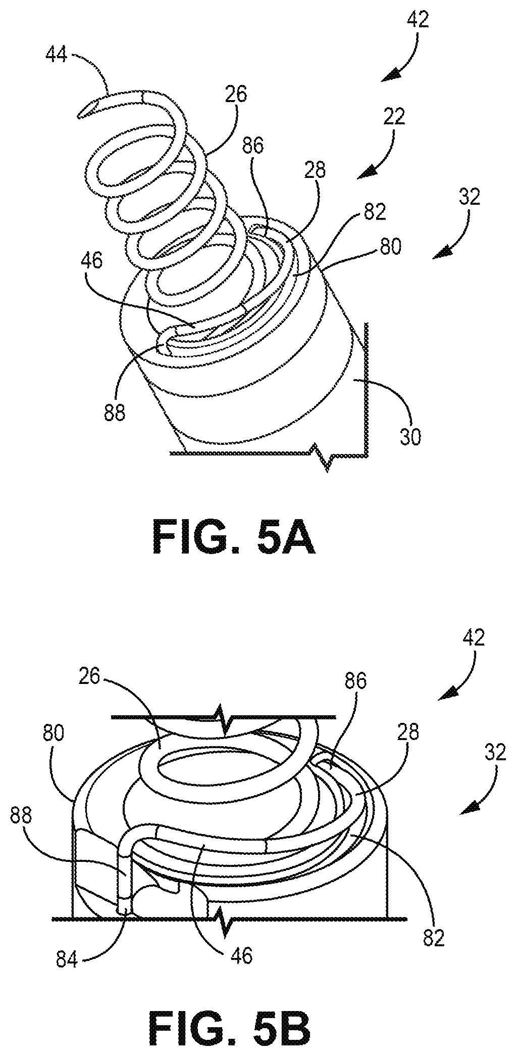 Patent US12303685 Figure 5 – Electrode configuration for a medical device