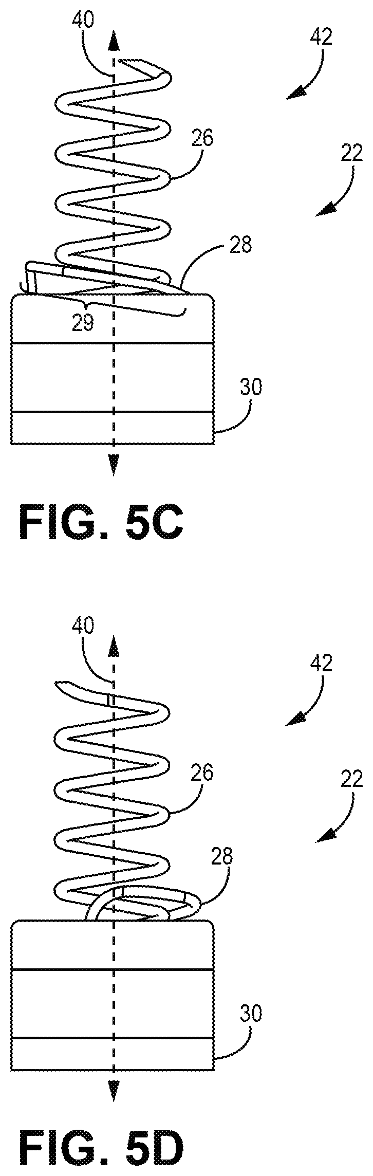 Patent US12303685 Figure 6 – Electrode configuration for a medical device