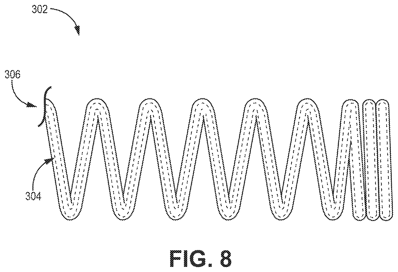 Patent US12303685 Figure 12 – Electrode configuration for a medical device