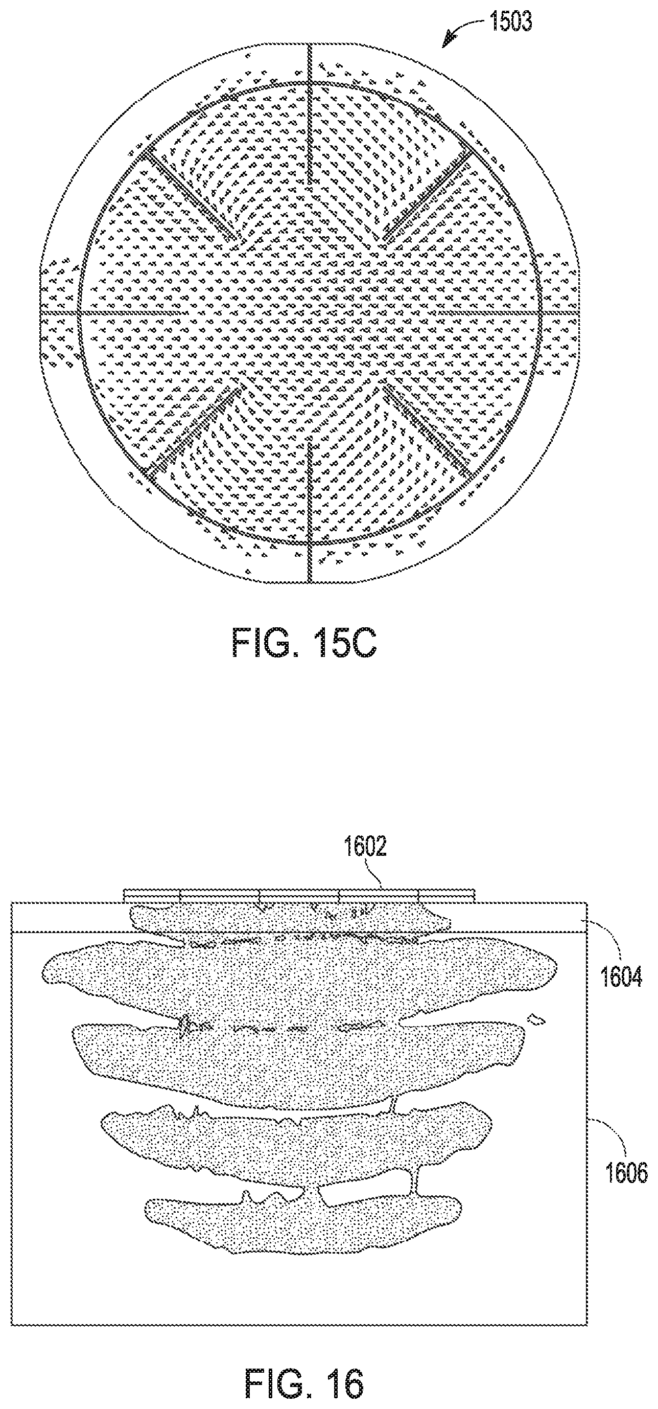 Patent US12303686 Figure 15 – Midfield power source for wireless implanted devices