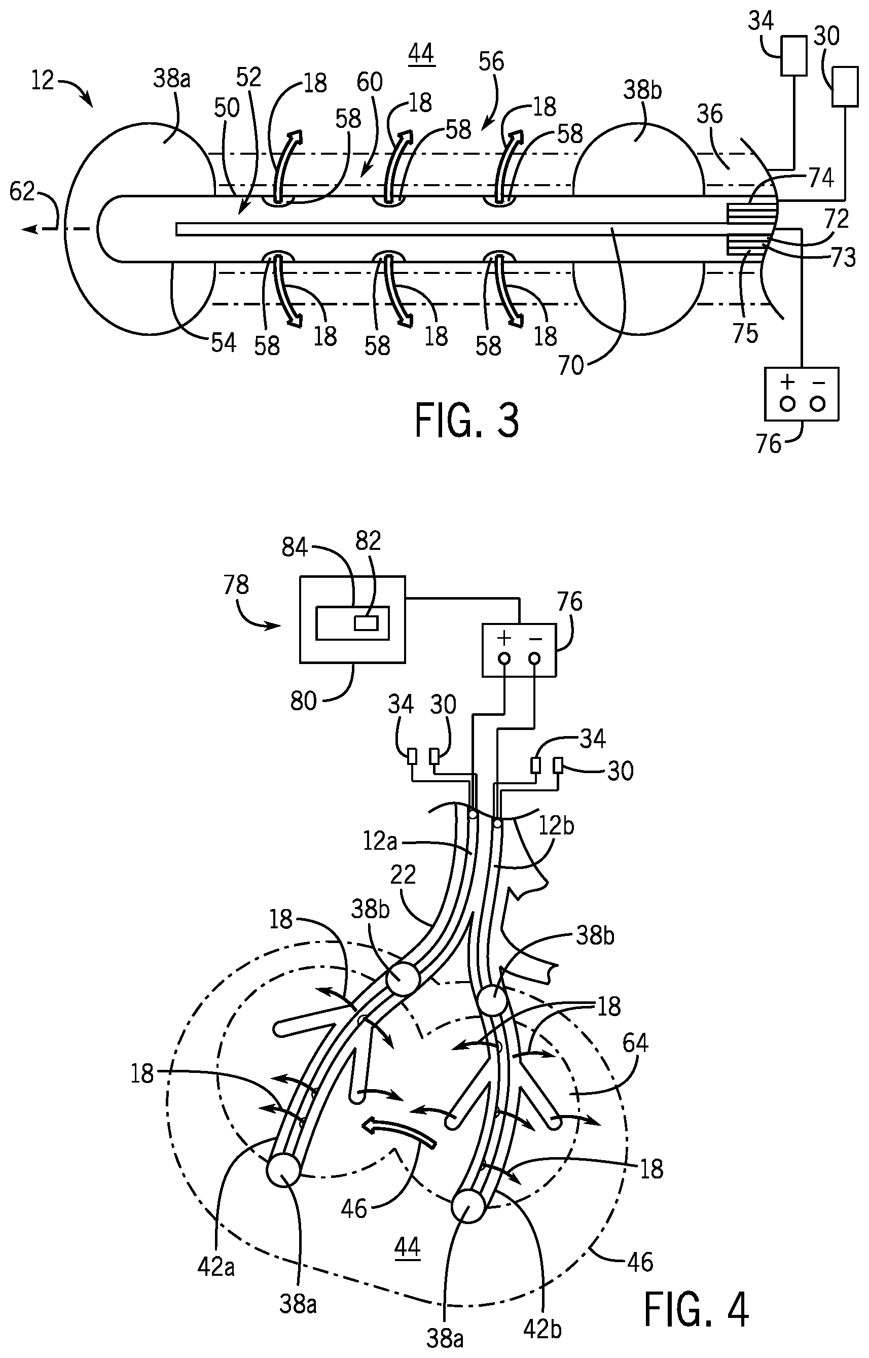 Patent US12303687 Figure 2 – In vivo gene therapy delivery procedure and device