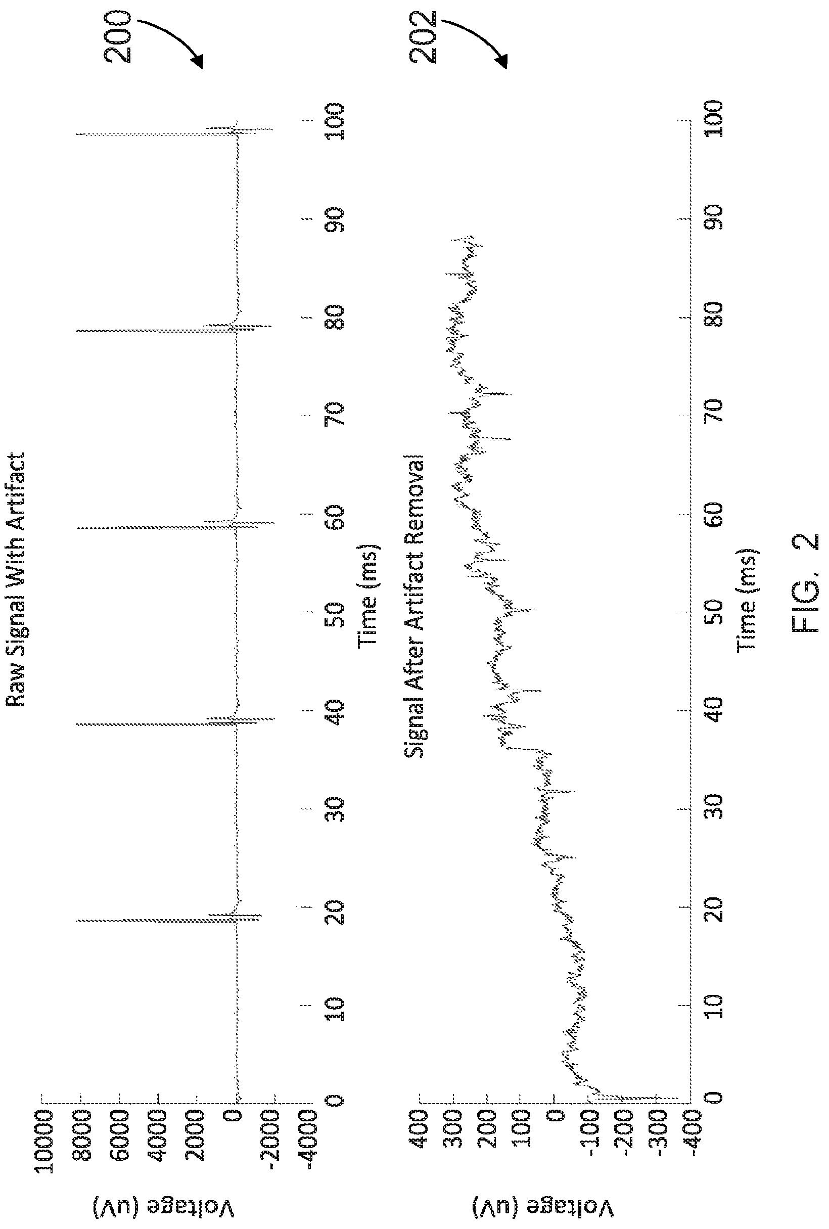 Patent US12303688 Figure 2 – Systems for neural bridging of the nervous system