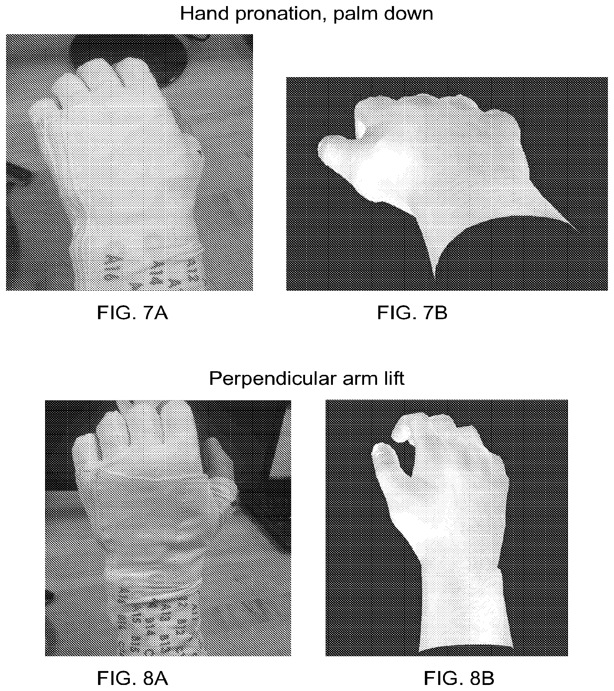 Patent US12303688 Figure 7 – Systems for neural bridging of the nervous system