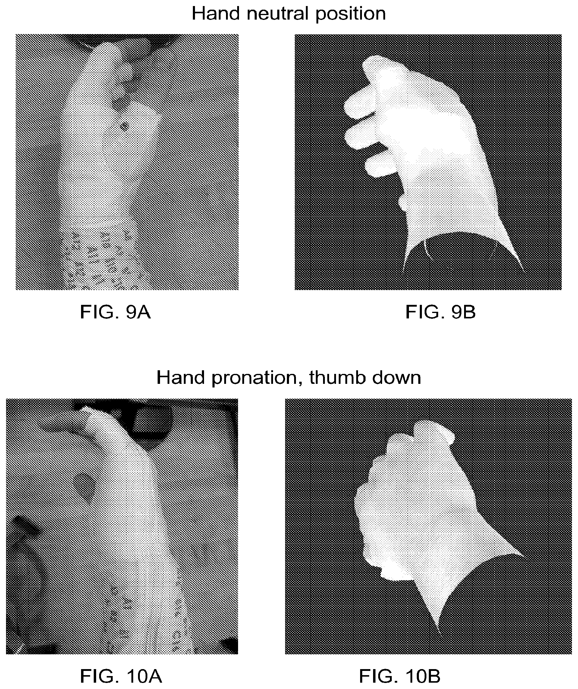 Patent US12303688 Figure 8 – Systems for neural bridging of the nervous system