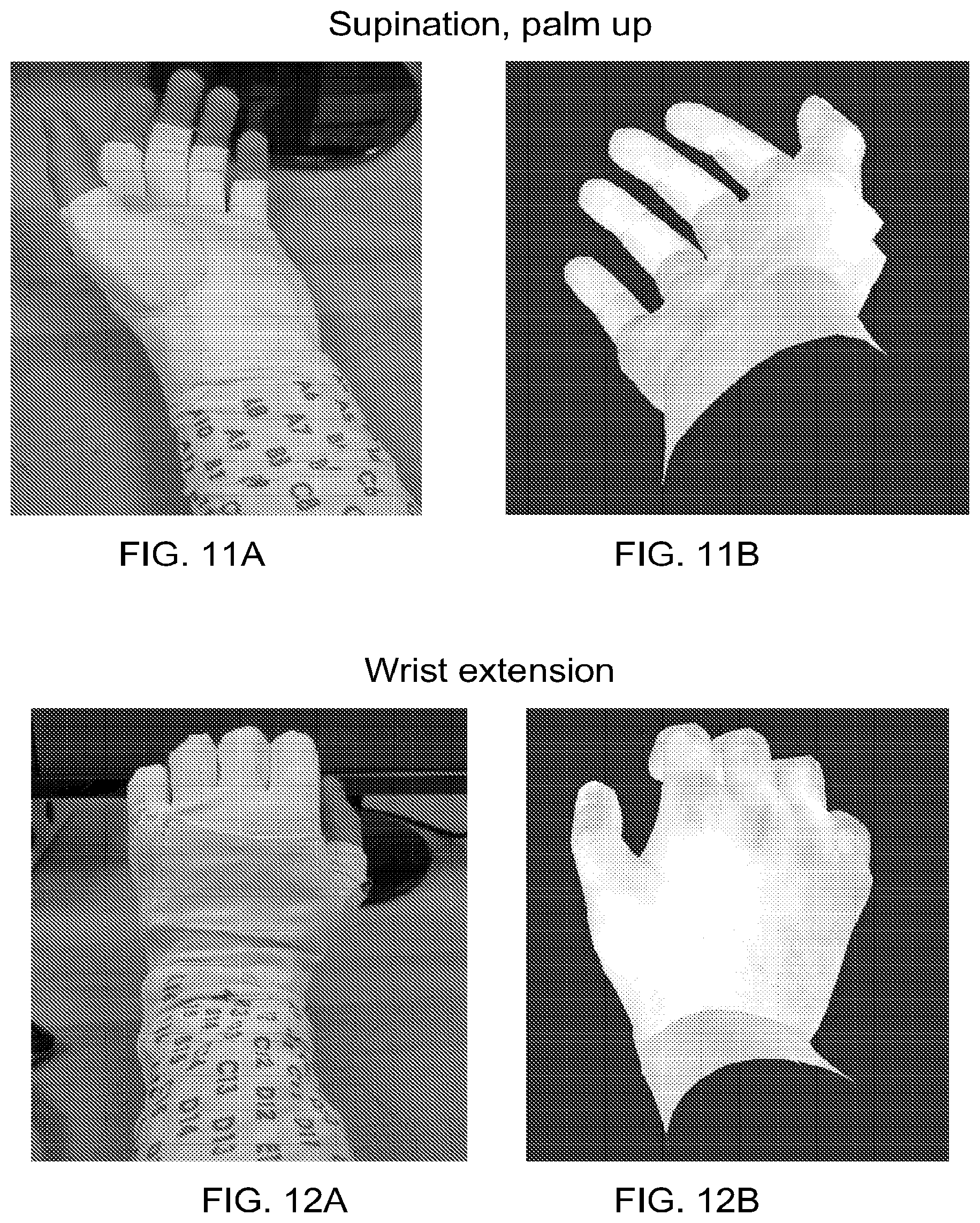 Patent US12303688 Figure 9 – Systems for neural bridging of the nervous system
