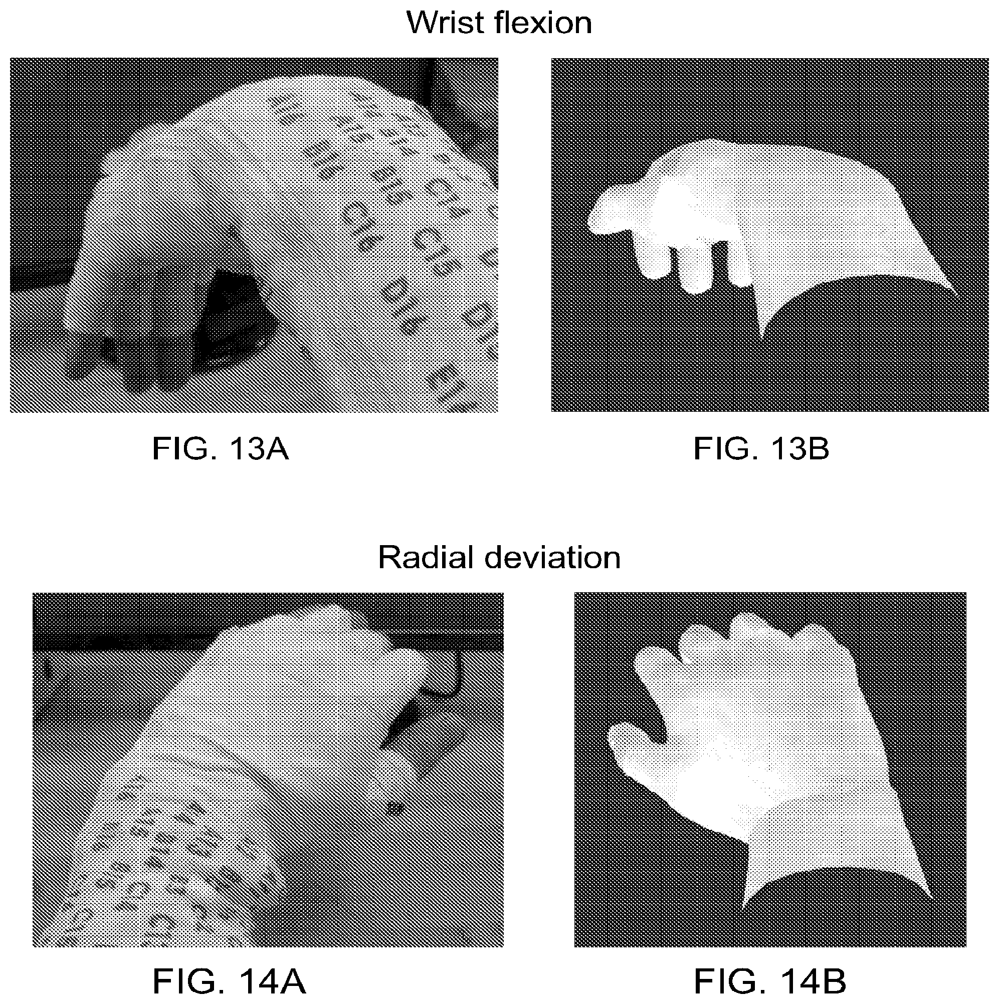 Patent US12303688 Figure 10 – Systems for neural bridging of the nervous system