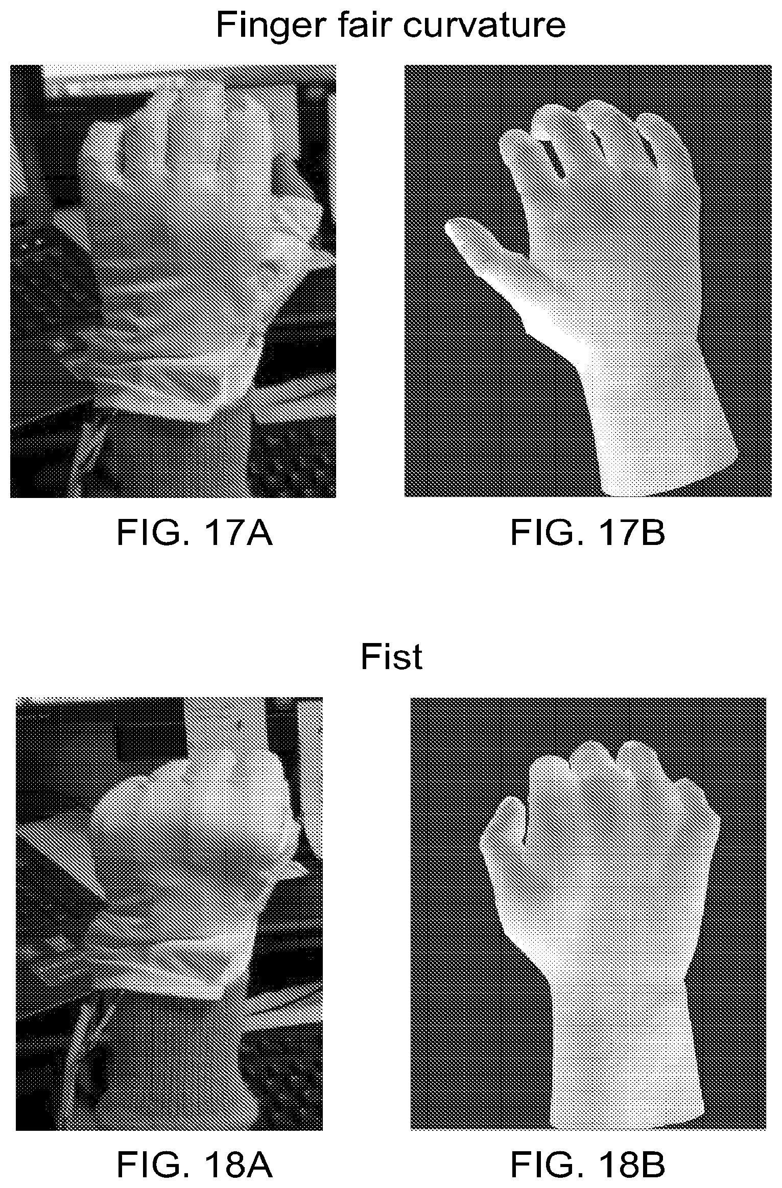 Patent US12303688 Figure 12 – Systems for neural bridging of the nervous system