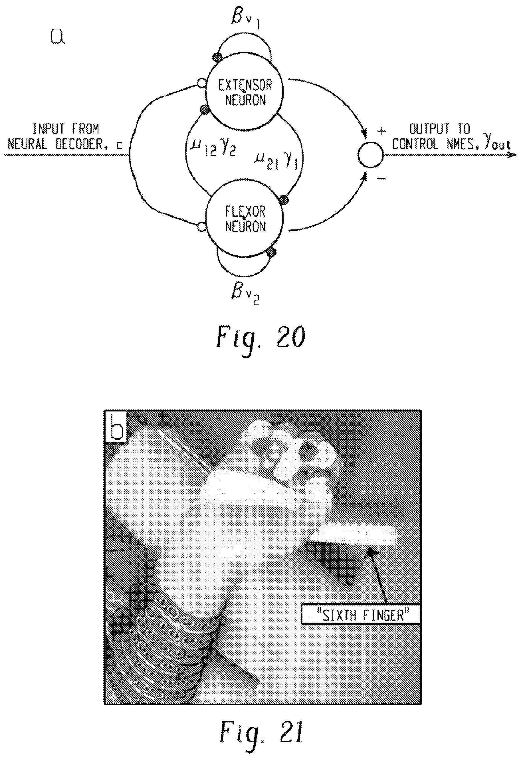 Patent US12303688 Figure 15 – Systems for neural bridging of the nervous system