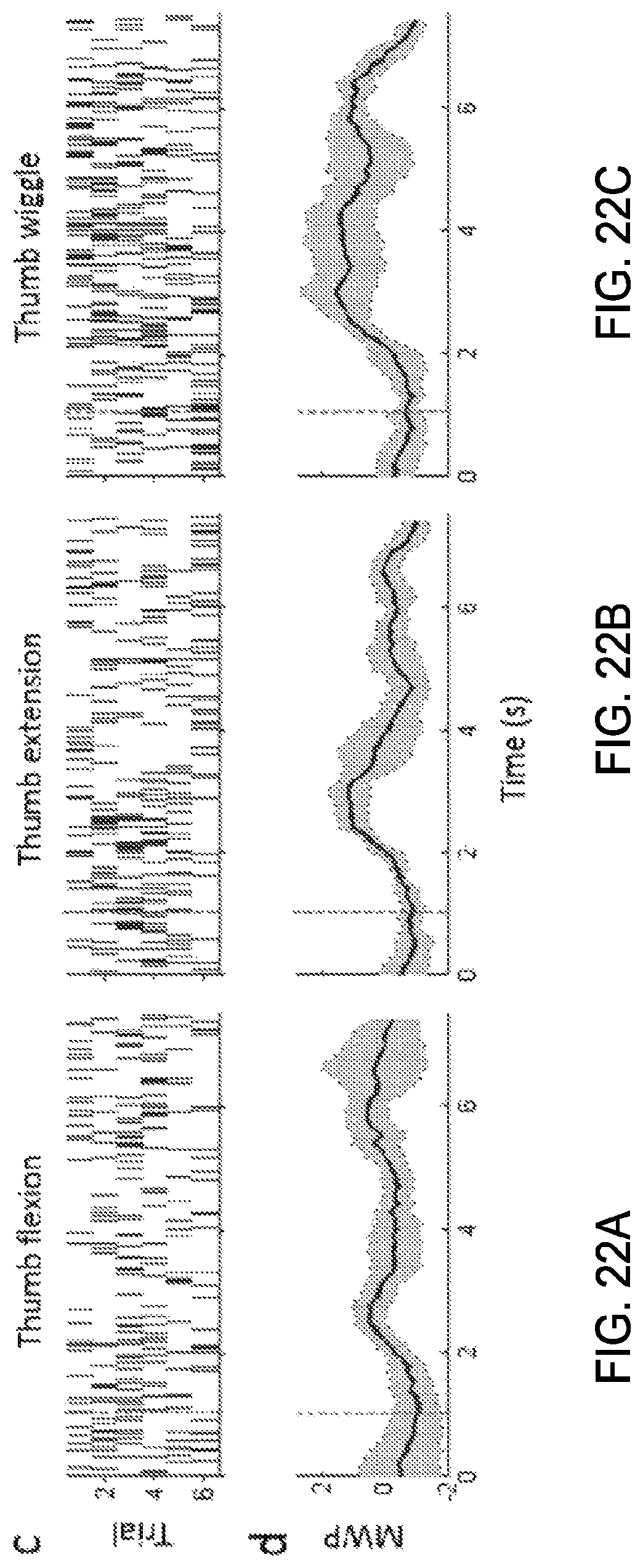 Patent US12303688 Figure 16 – Systems for neural bridging of the nervous system