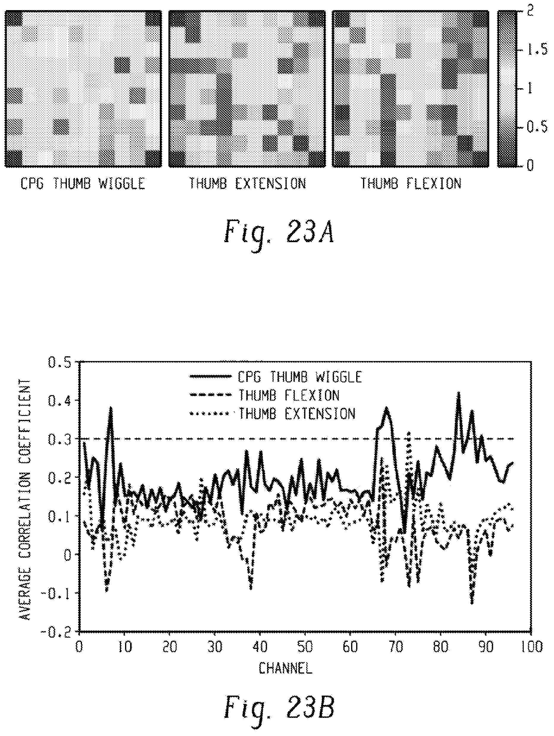 Patent US12303688 Figure 17 – Systems for neural bridging of the nervous system
