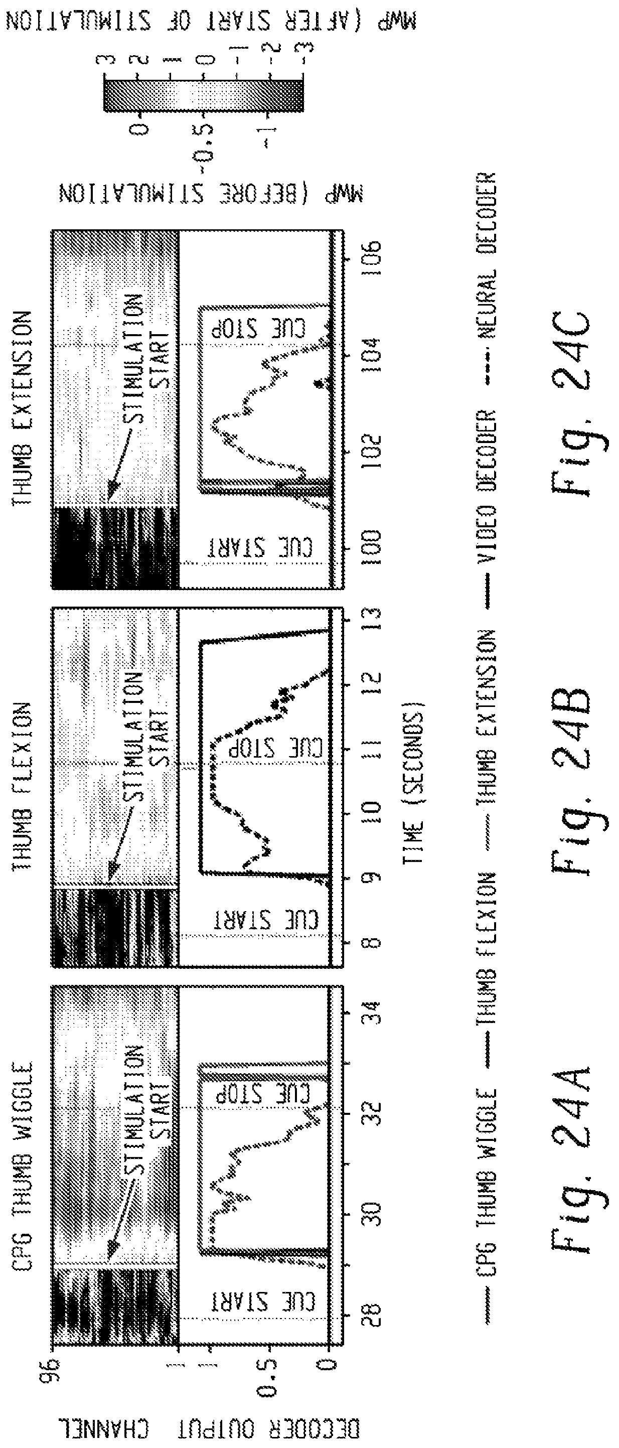 Patent US12303688 Figure 19 – Systems for neural bridging of the nervous system