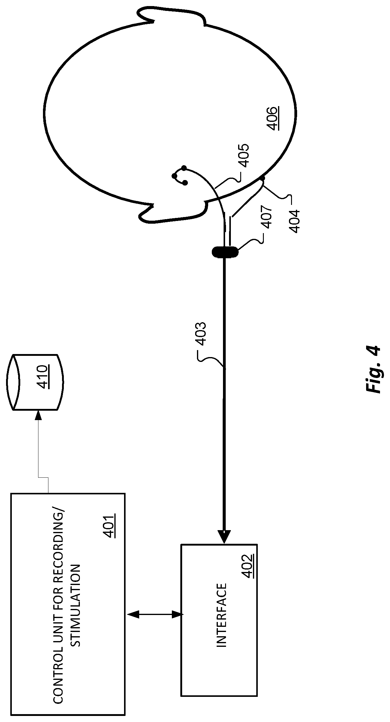 Patent US12303689 Figure 4 – Polyphonic pitch enhancement in a cochlear implant