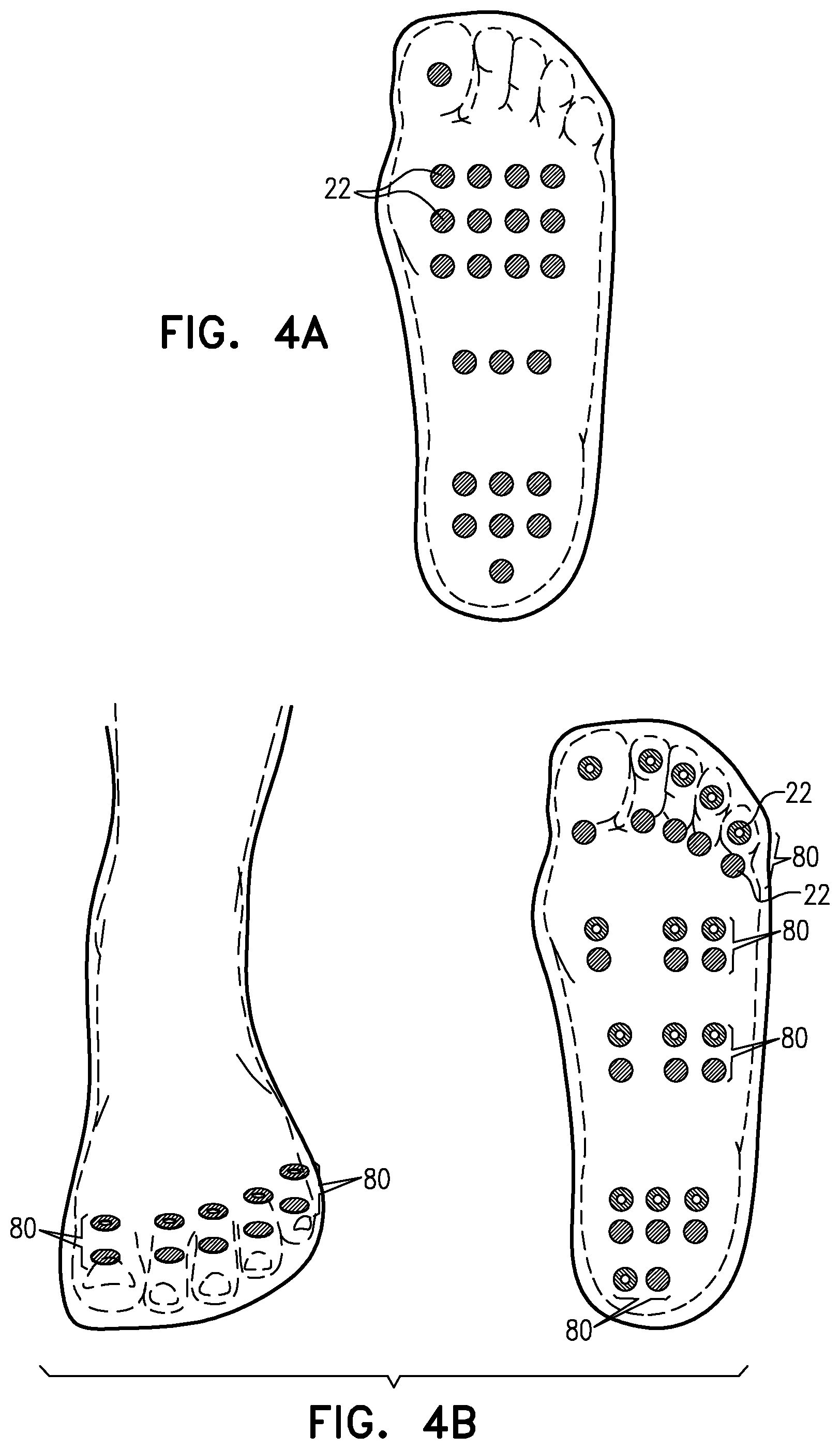 Patent US12303690 Figure 4 – Apparatus and methods for improving sensory nerve sensitivity