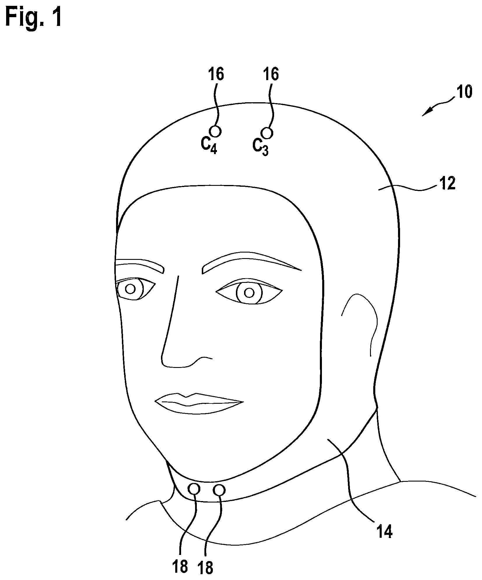 Patent US12303691 Figure 1 – Device and method for determining sleep apnea