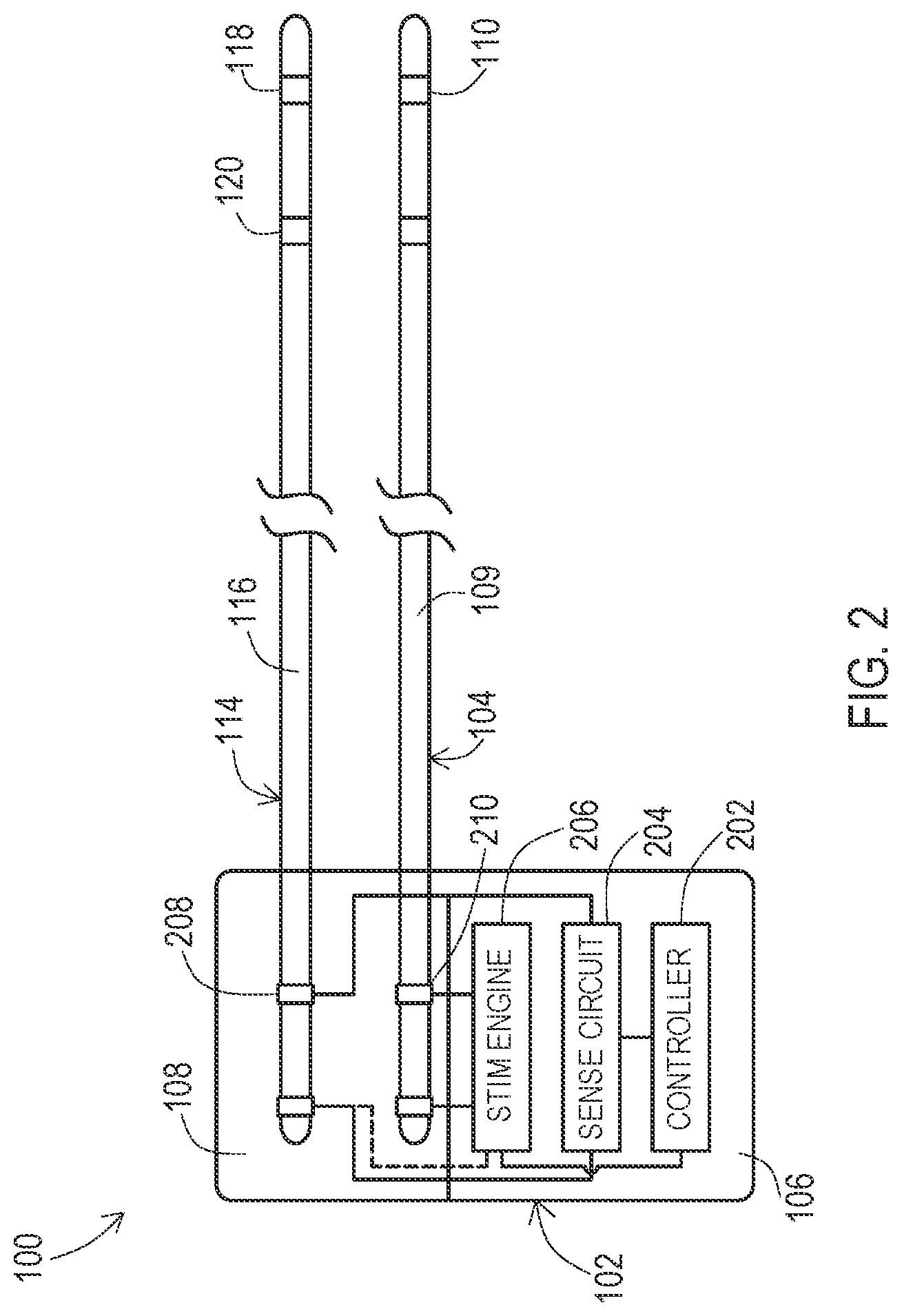 Patent US12303692 Figure 2 – Devices and methods for sensing physiological signals during stimulation therapy