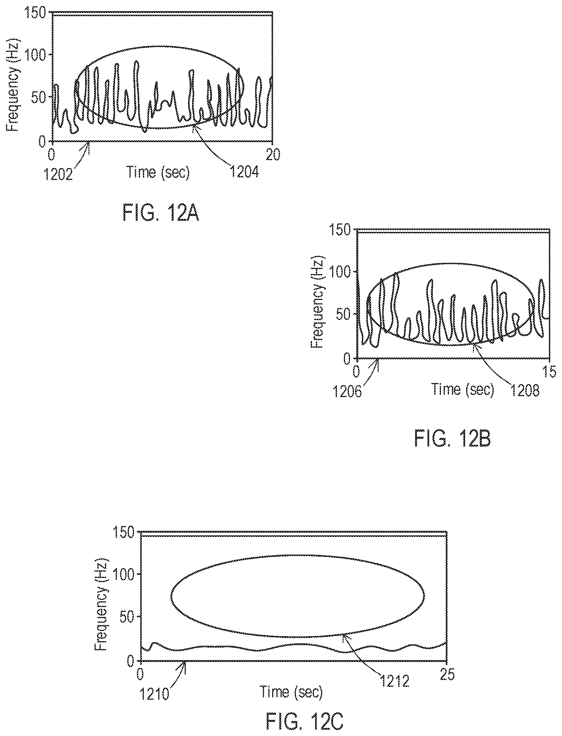 Patent US12303692 Figure 8 – Devices and methods for sensing physiological signals during stimulation therapy