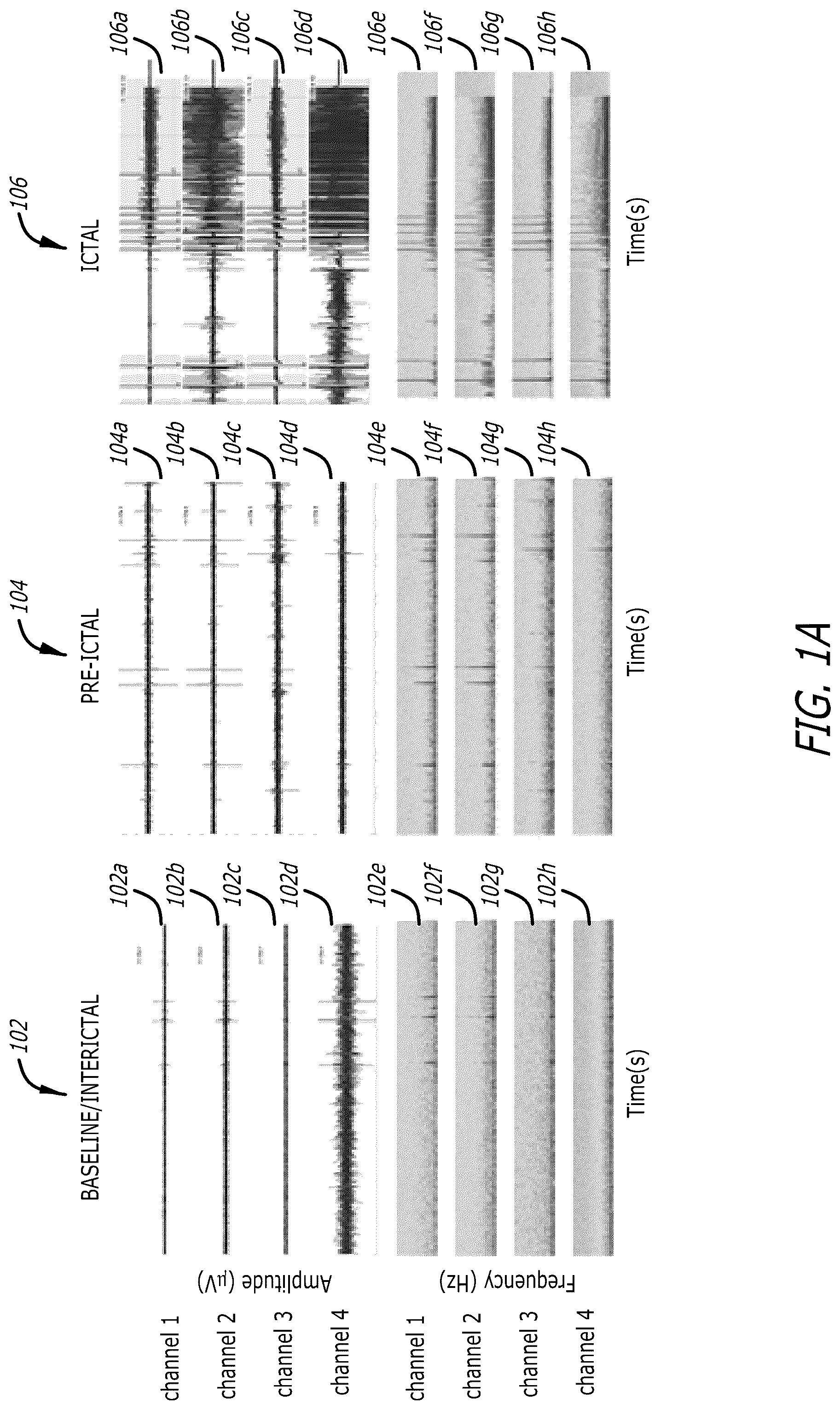 Patent US12303693 Figure 1 – Systems and methods for controlling operation of an implanted neurostimulation system based on a mapping of episode durations and seizure probability biomarkers