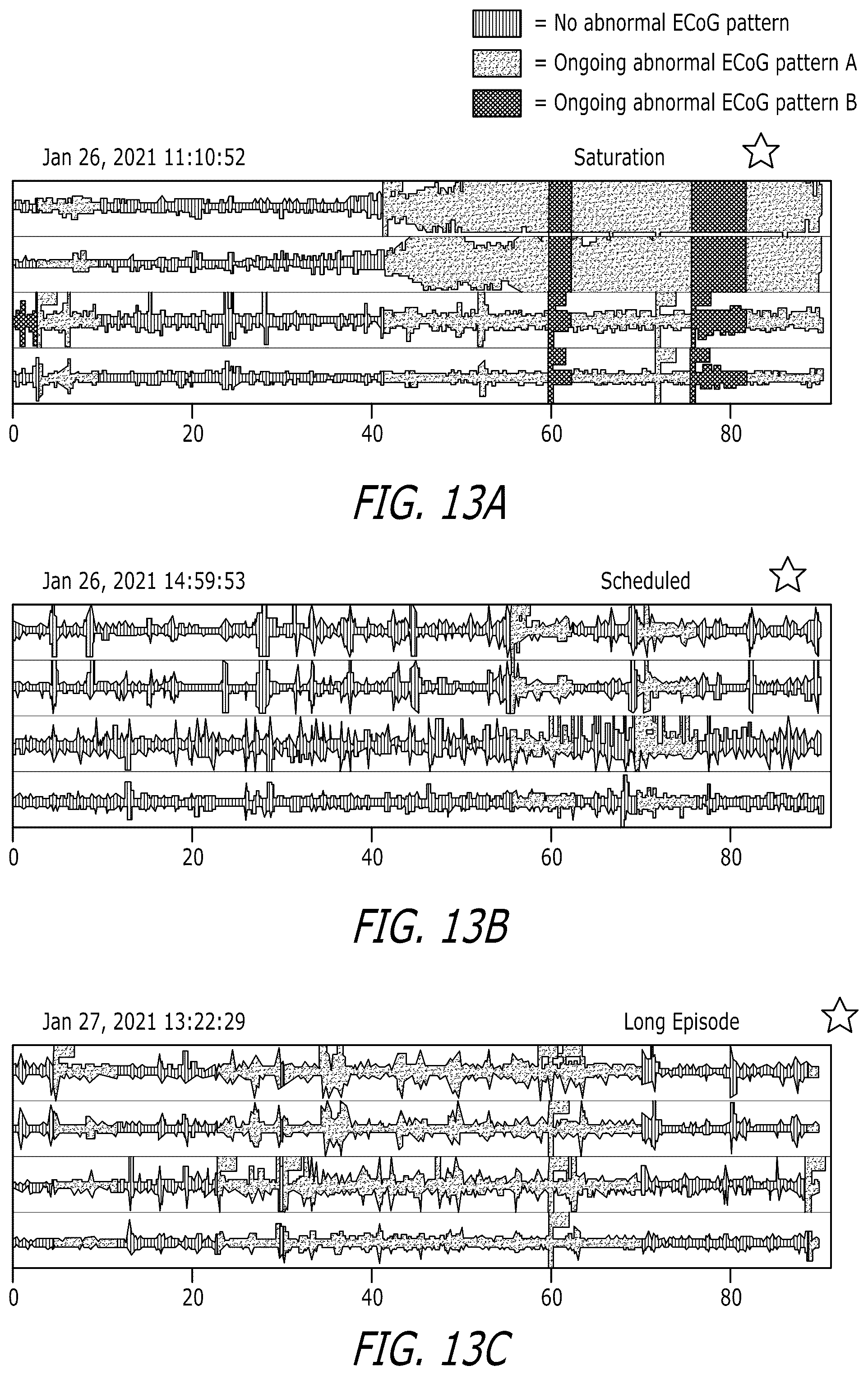 Patent US12303693 Figure 19 – Systems and methods for controlling operation of an implanted neurostimulation system based on a mapping of episode durations and seizure probability biomarkers