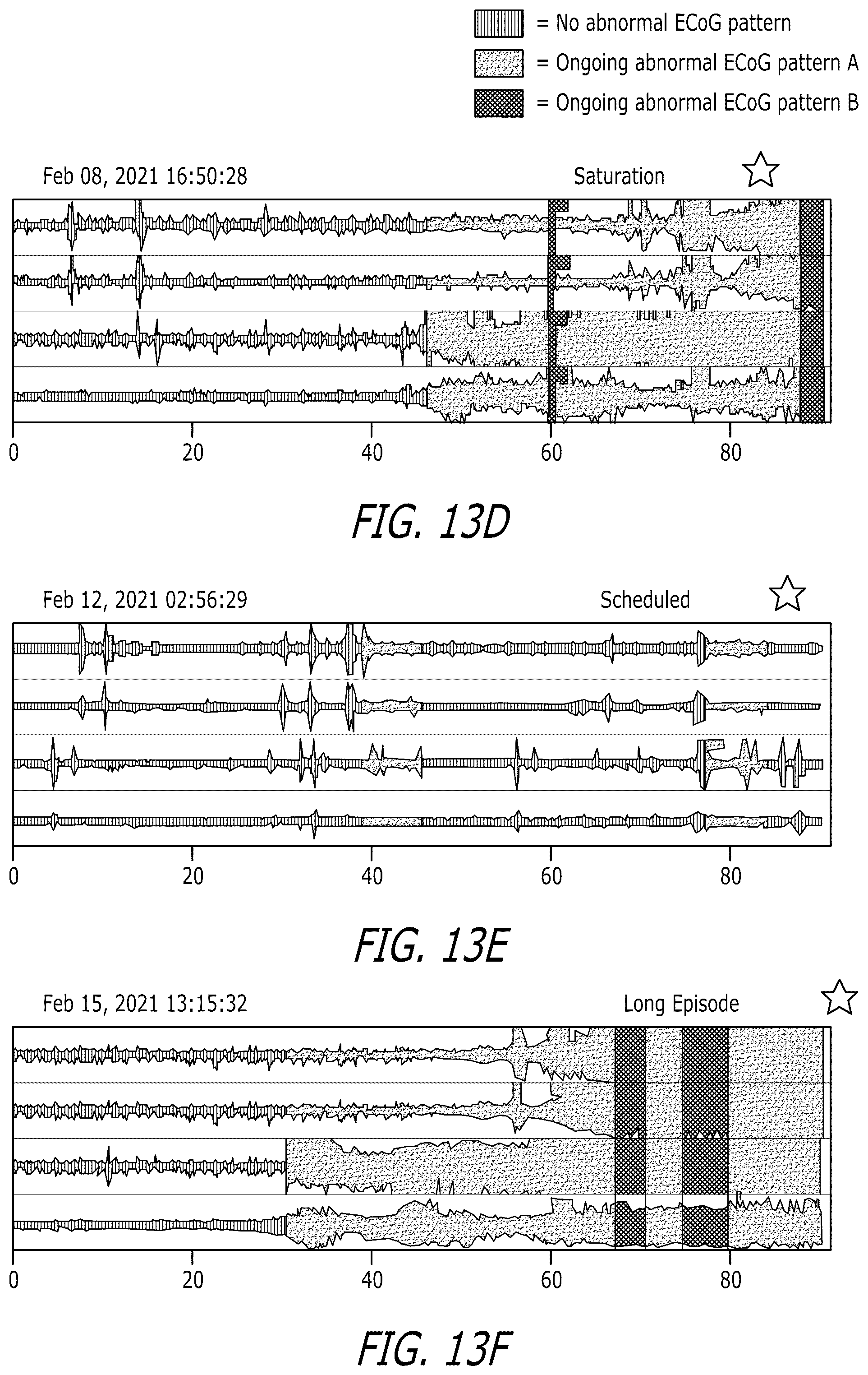 Patent US12303693 Figure 20 – Systems and methods for controlling operation of an implanted neurostimulation system based on a mapping of episode durations and seizure probability biomarkers