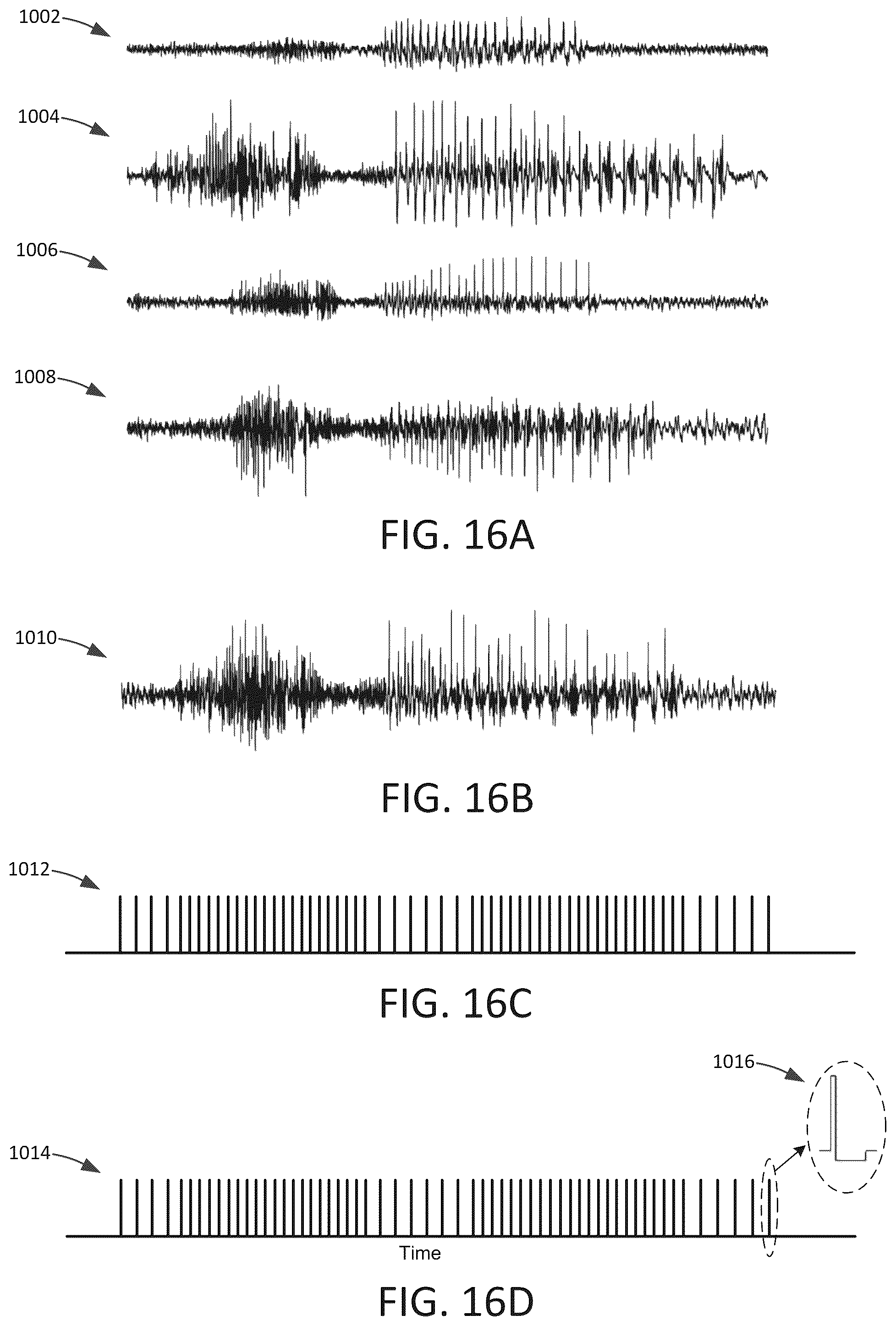 Patent US12303694 Figure 15 – Methods and systems for optimizing therapy using stimulation mimicking natural seizures
