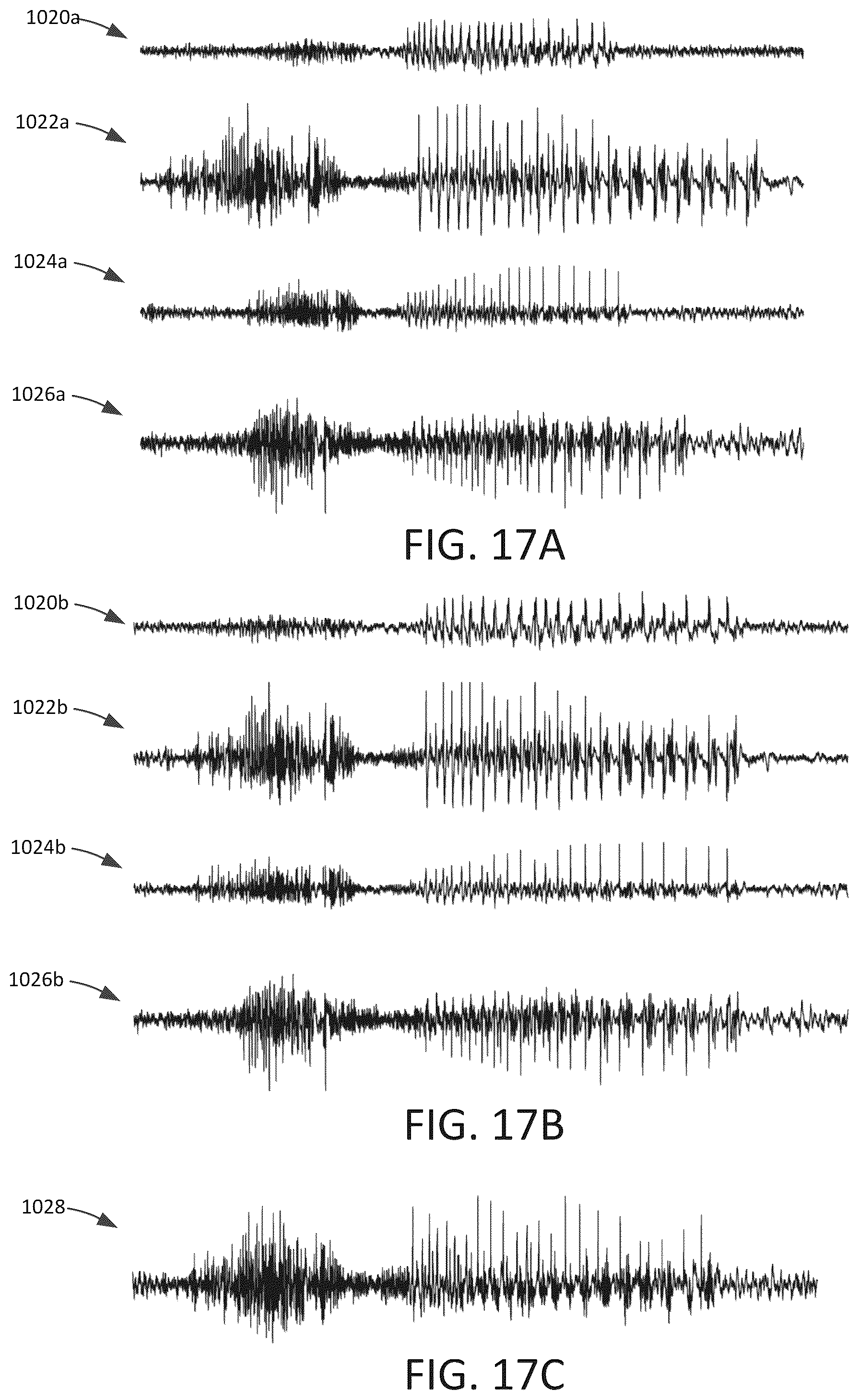 Patent US12303694 Figure 16 – Methods and systems for optimizing therapy using stimulation mimicking natural seizures