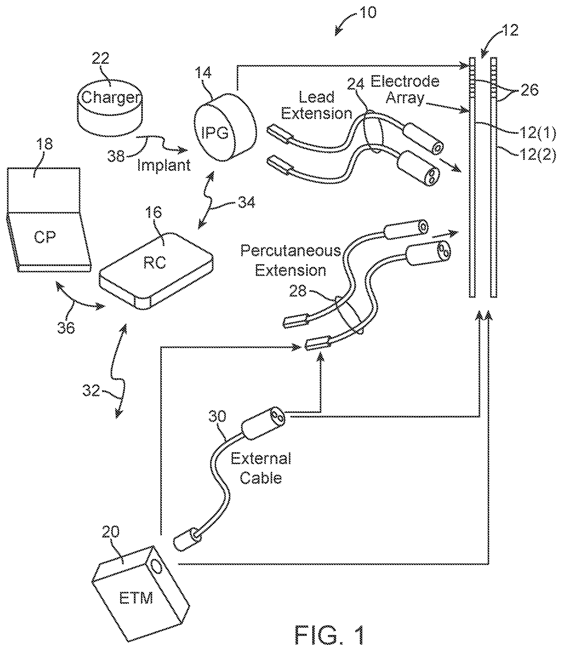 Patent US12303695 Figure 1 – Systems and methods of providing modulation therapy without patient-perception of stimulation