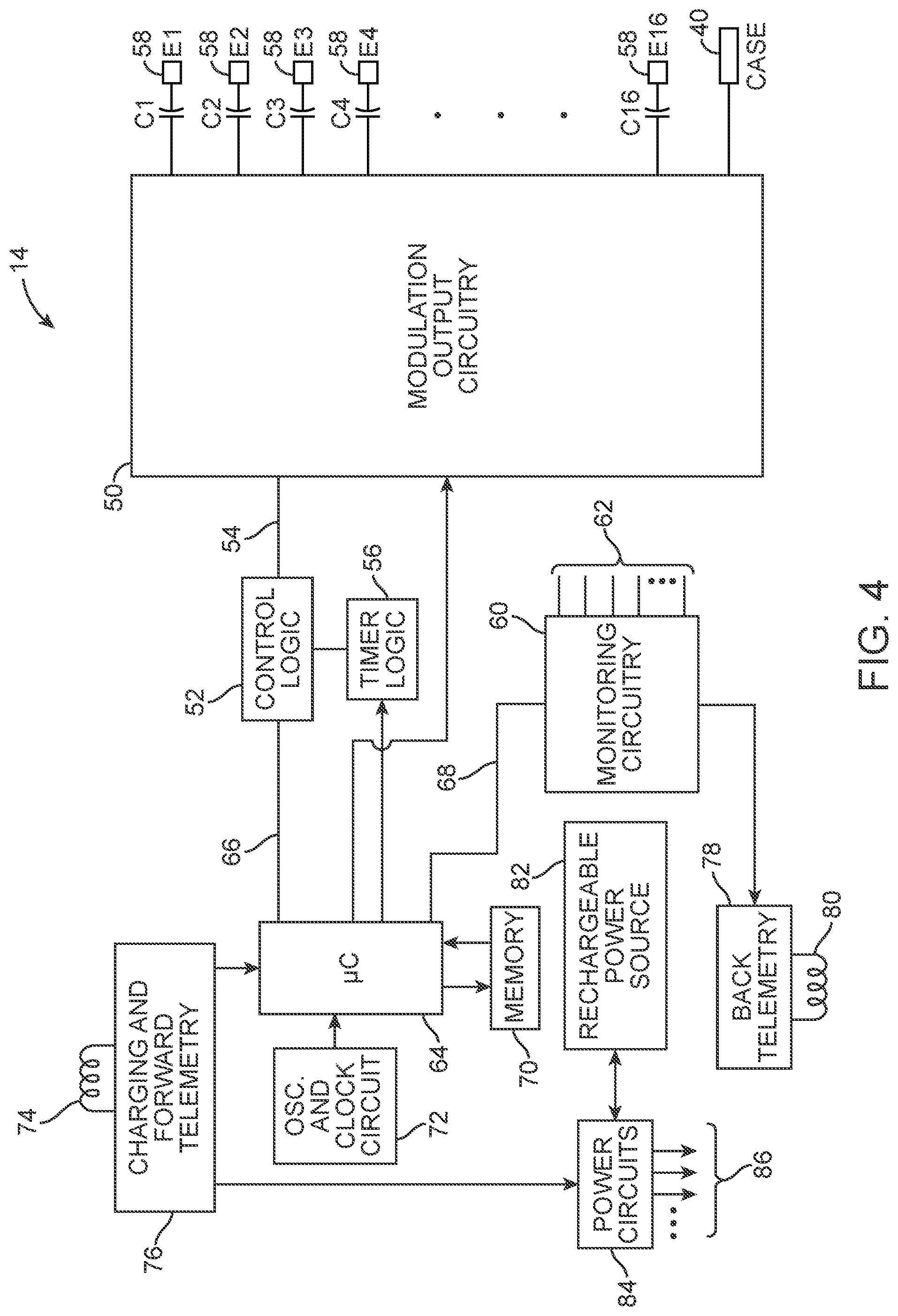 Patent US12303695 Figure 4 – Systems and methods of providing modulation therapy without patient-perception of stimulation