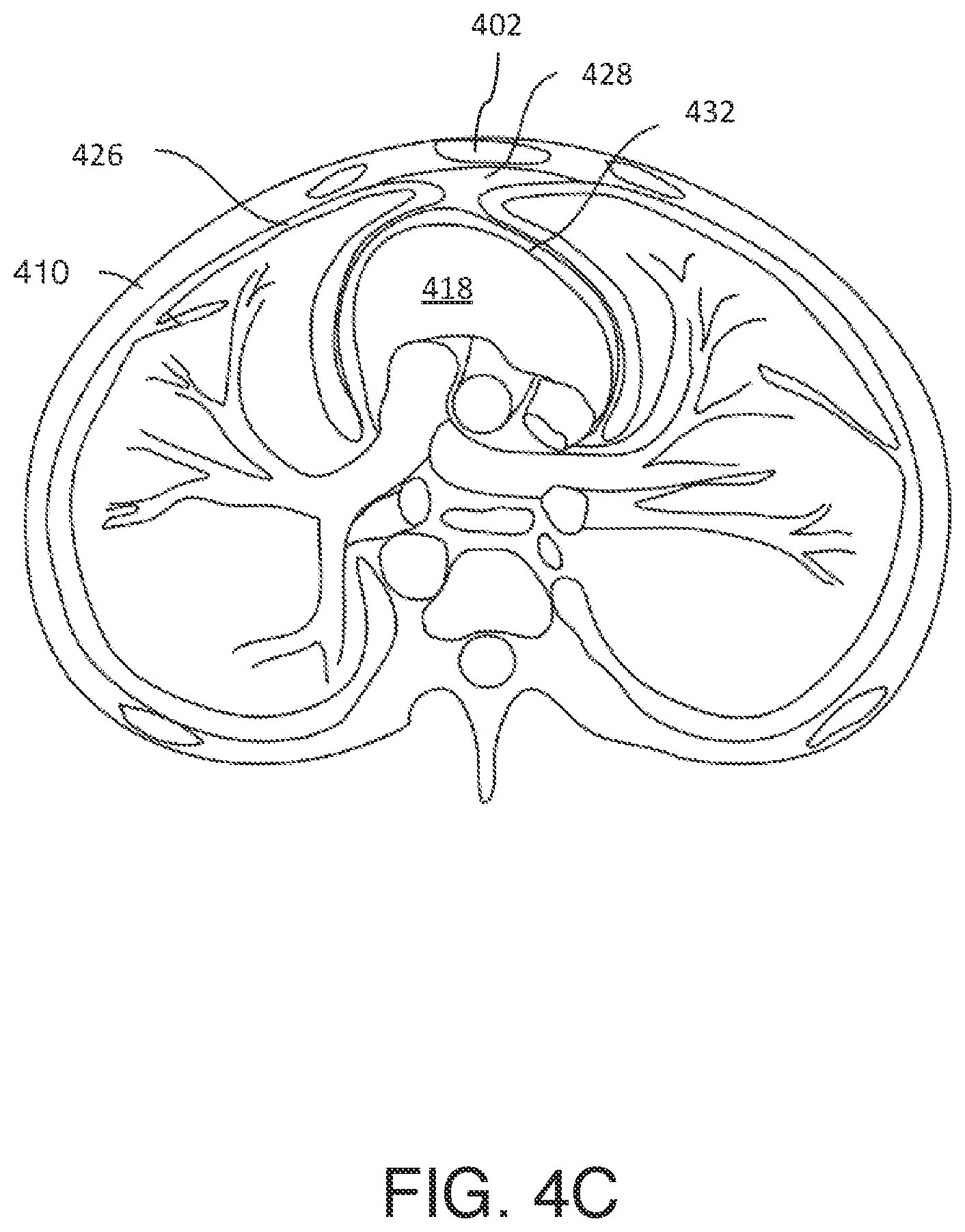 Patent US12303696 Figure 6 – Cardiac pacing sensing and control