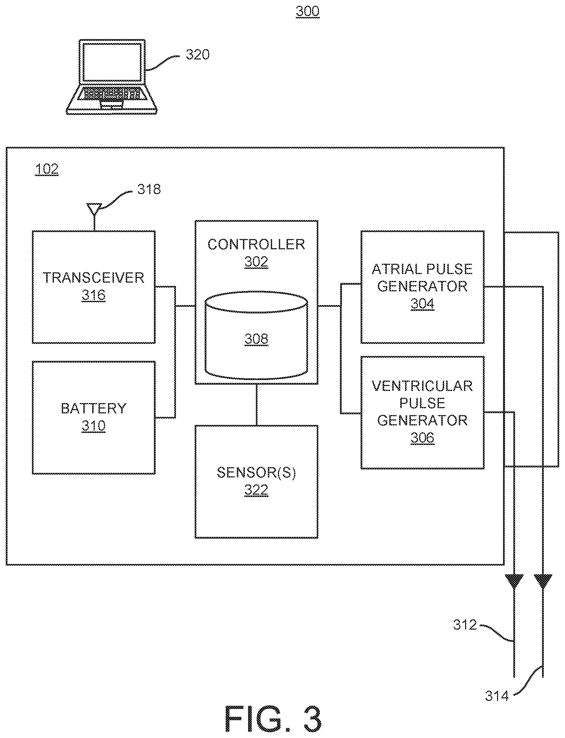 Patent US12303697 Figure 3 – Cardiac pacing sensing and control