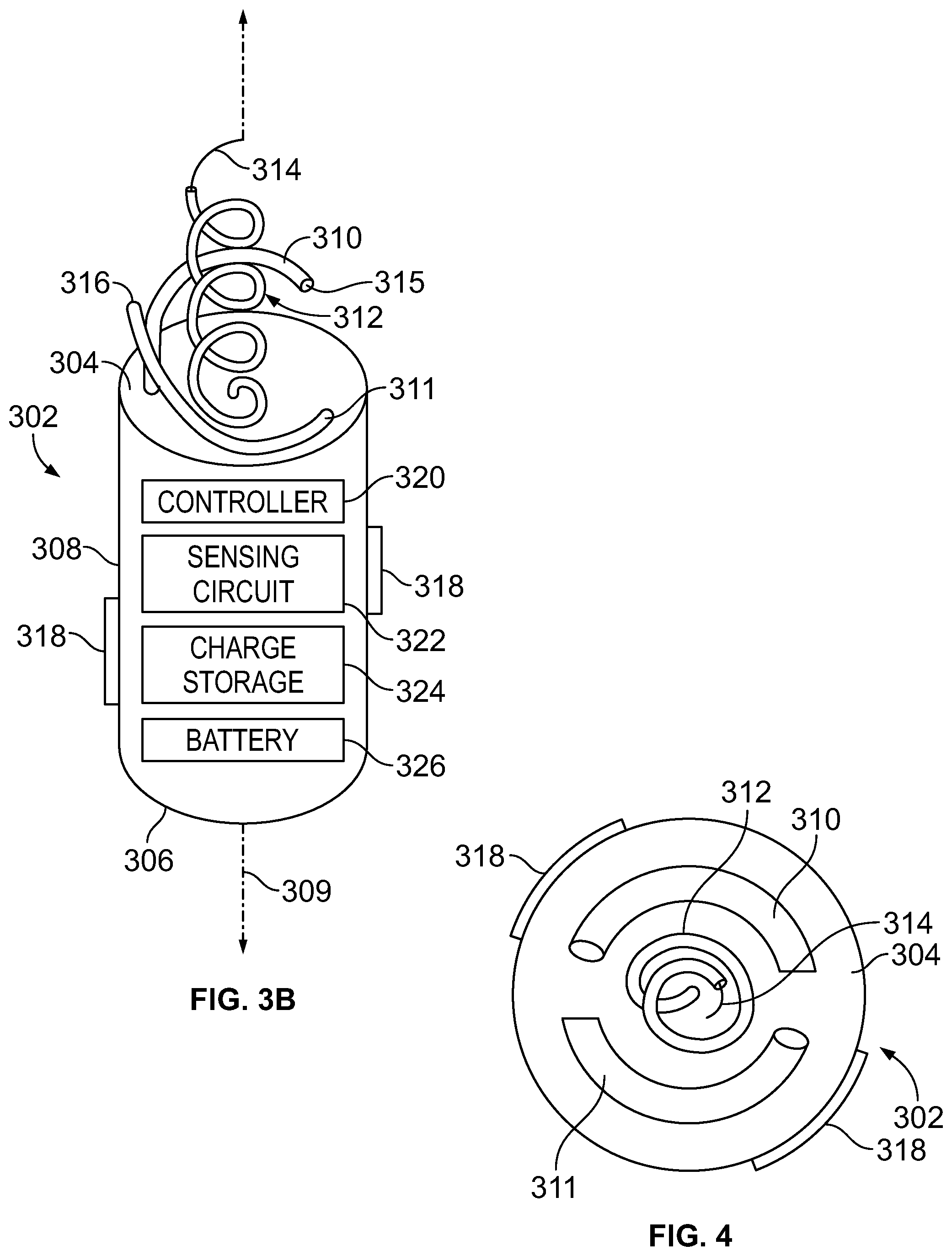 Patent US12303699 Figure 4 – Method and device for avoiding competitive atrial pacing