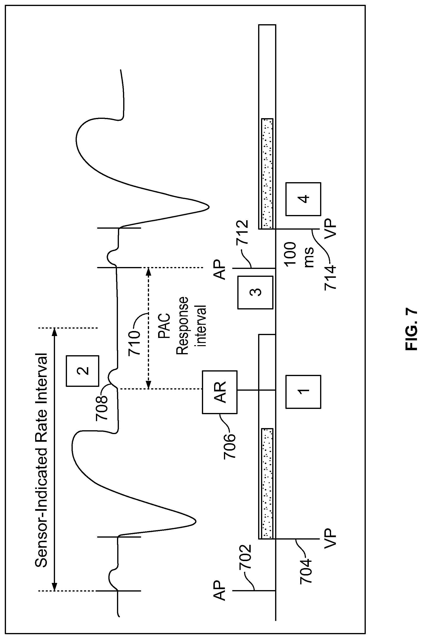 Patent US12303699 Figure 9 – Method and device for avoiding competitive atrial pacing