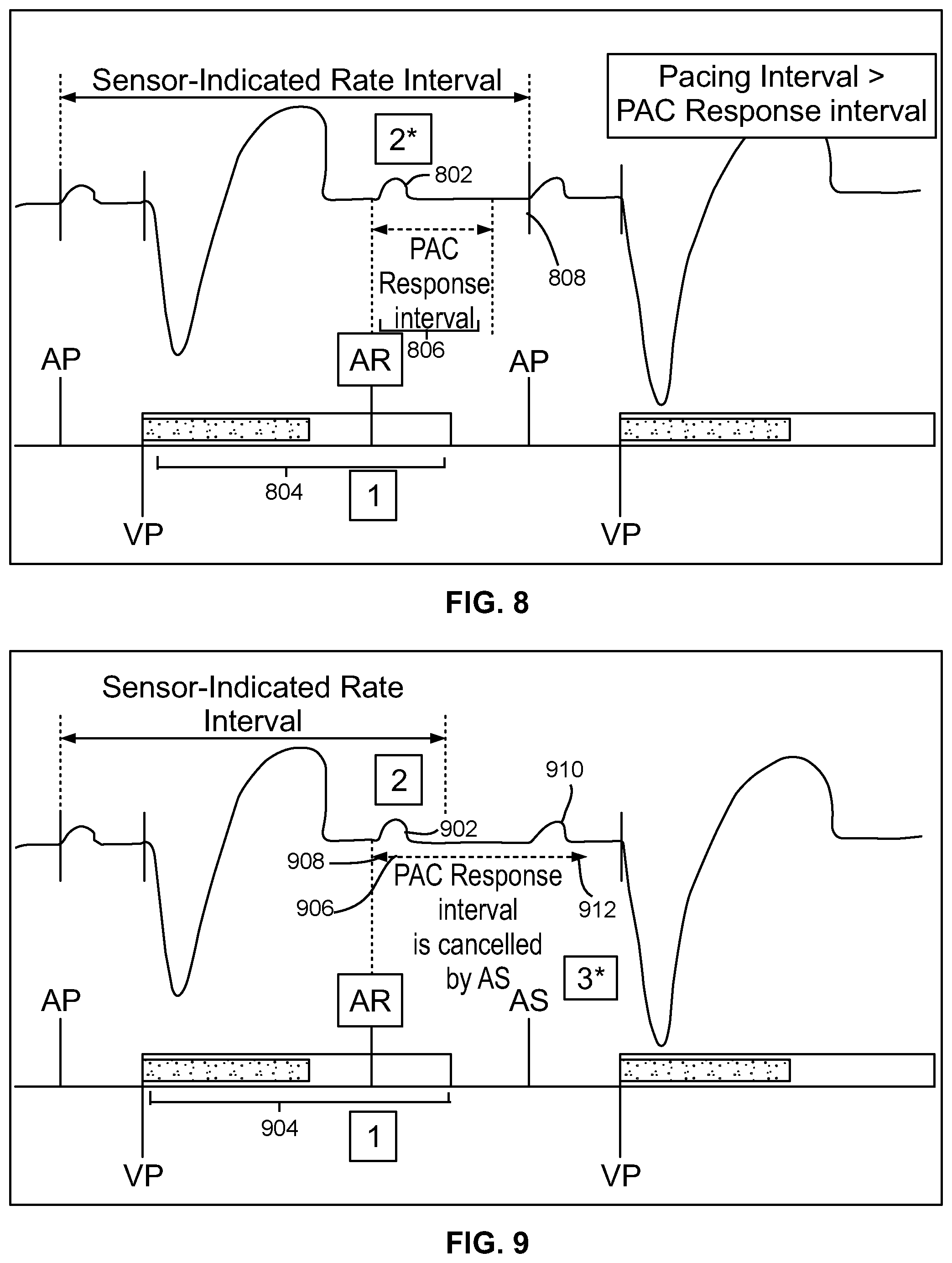 Patent US12303699 Figure 10 – Method and device for avoiding competitive atrial pacing