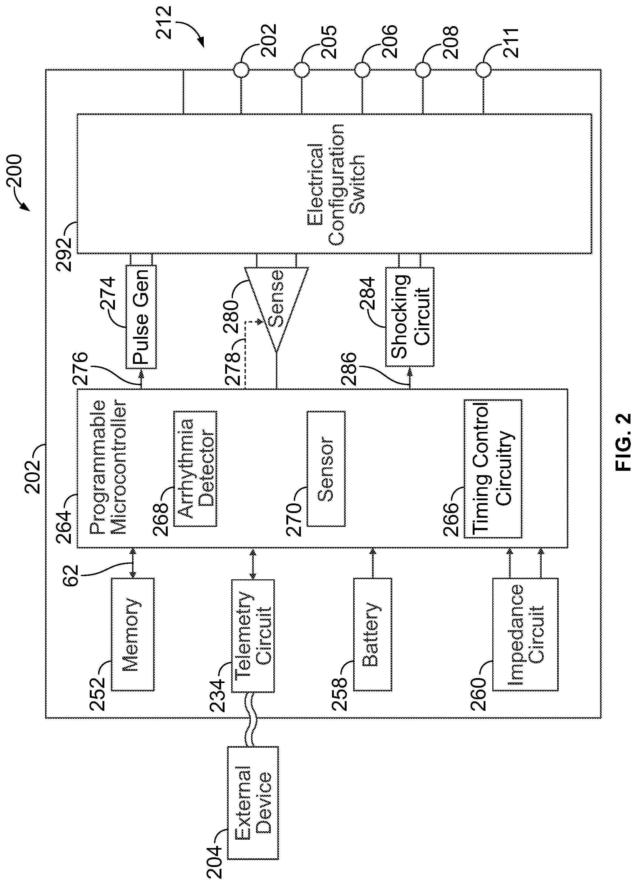 Patent US12303700 Figure 2 – Method and system for implanting a septal wall electrode