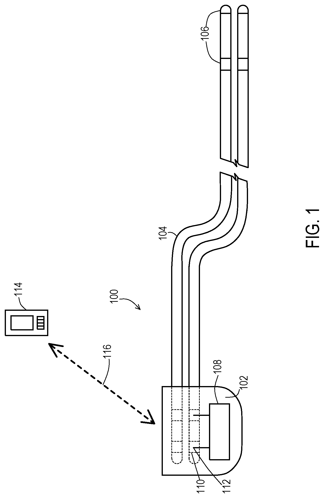 Patent US12303701 Figure 1 – Methods and implantable medical systems that implement exposure modes of therapy that allow for continued operation during exposure to a magnetic disturbance