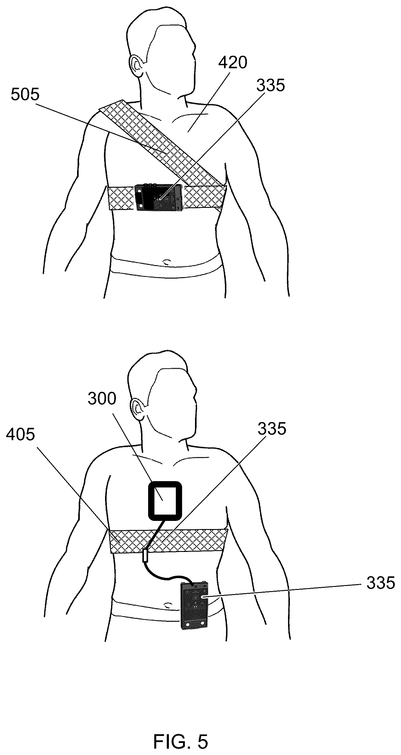 Patent US12303703 Figure 5 – Method of using a medical device