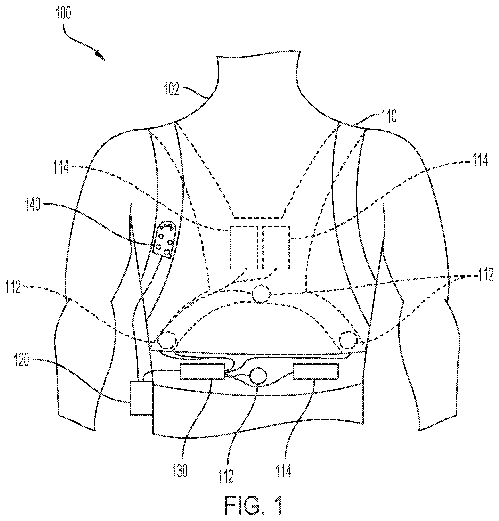 Patent US12303704 Figure 1 – Water-resistant electrocardiogram sensor assembly for a wearable medical device