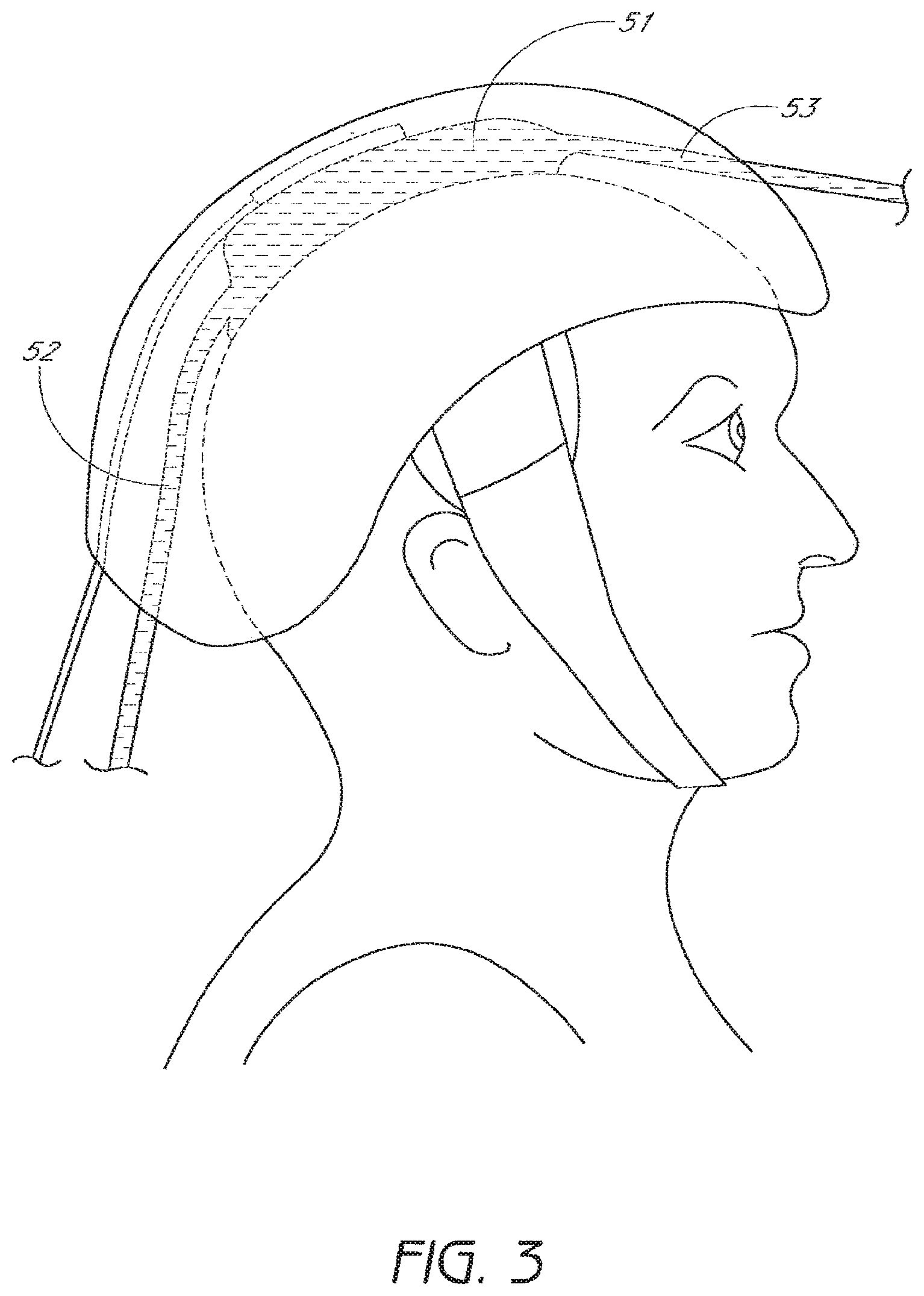 Patent US12303709 Figure 3 – Light-emitting device and method for providing phototherapy to the brain