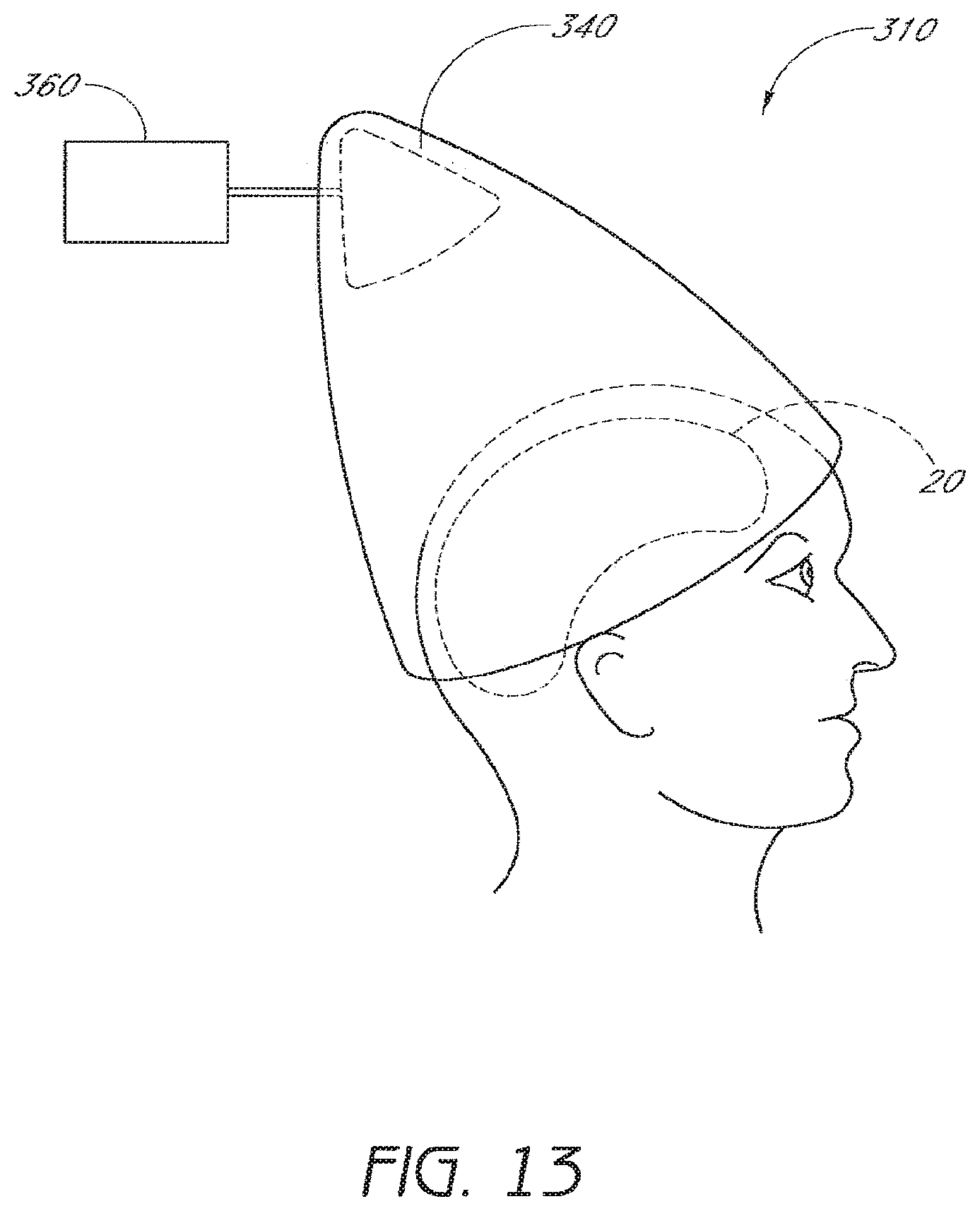 Patent US12303709 Figure 15 – Light-emitting device and method for providing phototherapy to the brain