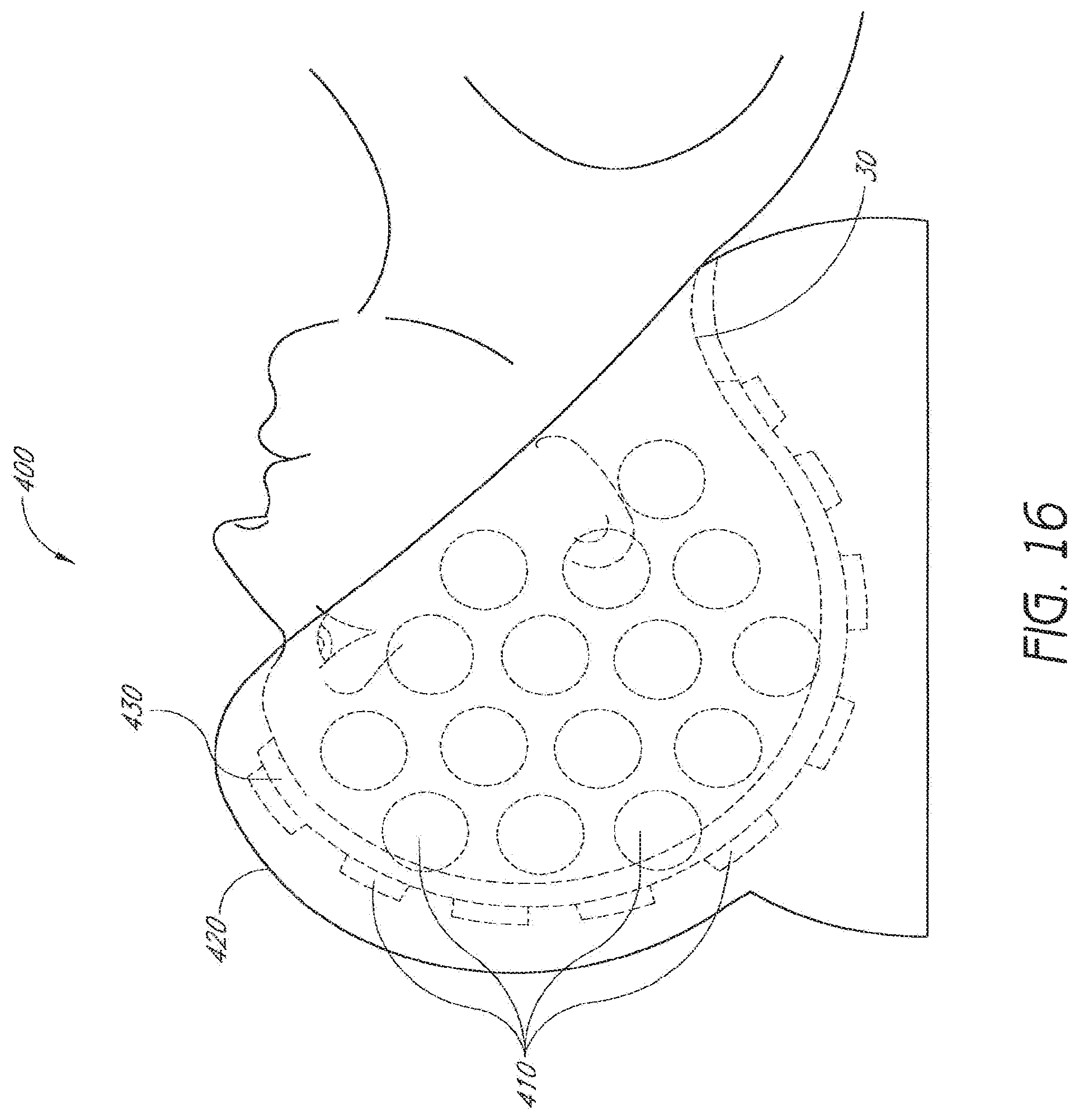 Patent US12303709 Figure 18 – Light-emitting device and method for providing phototherapy to the brain