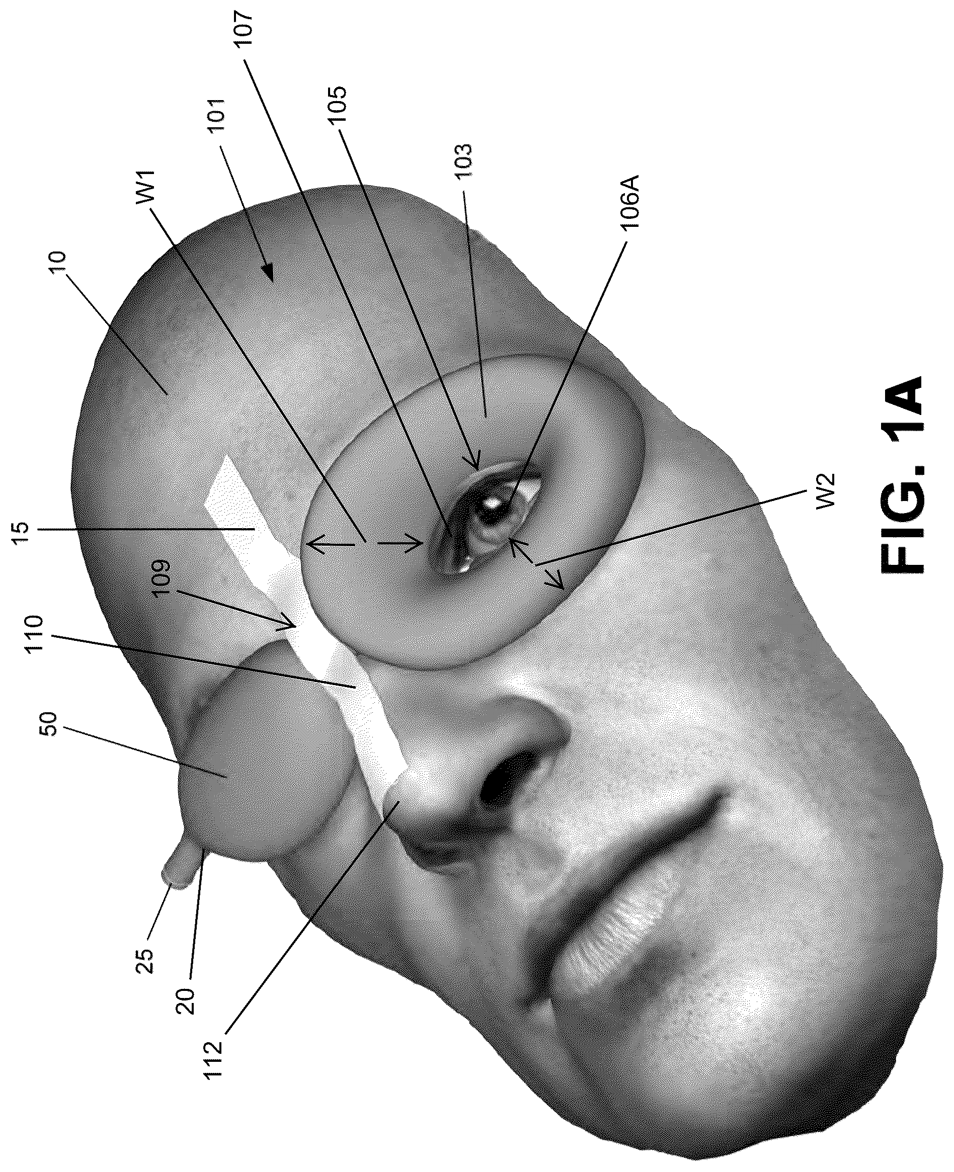 Patent US12303712 — Conformal system for therapeutic beta or low-energy gamma radiation shielding — Figure 1