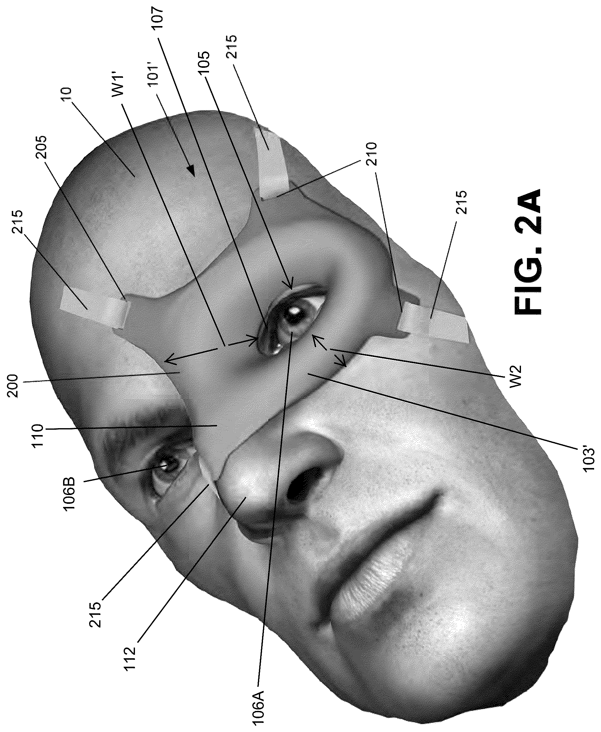 Patent US12303712 Figure 3 – Conformal system for therapeutic beta or low-energy gamma radiation shielding