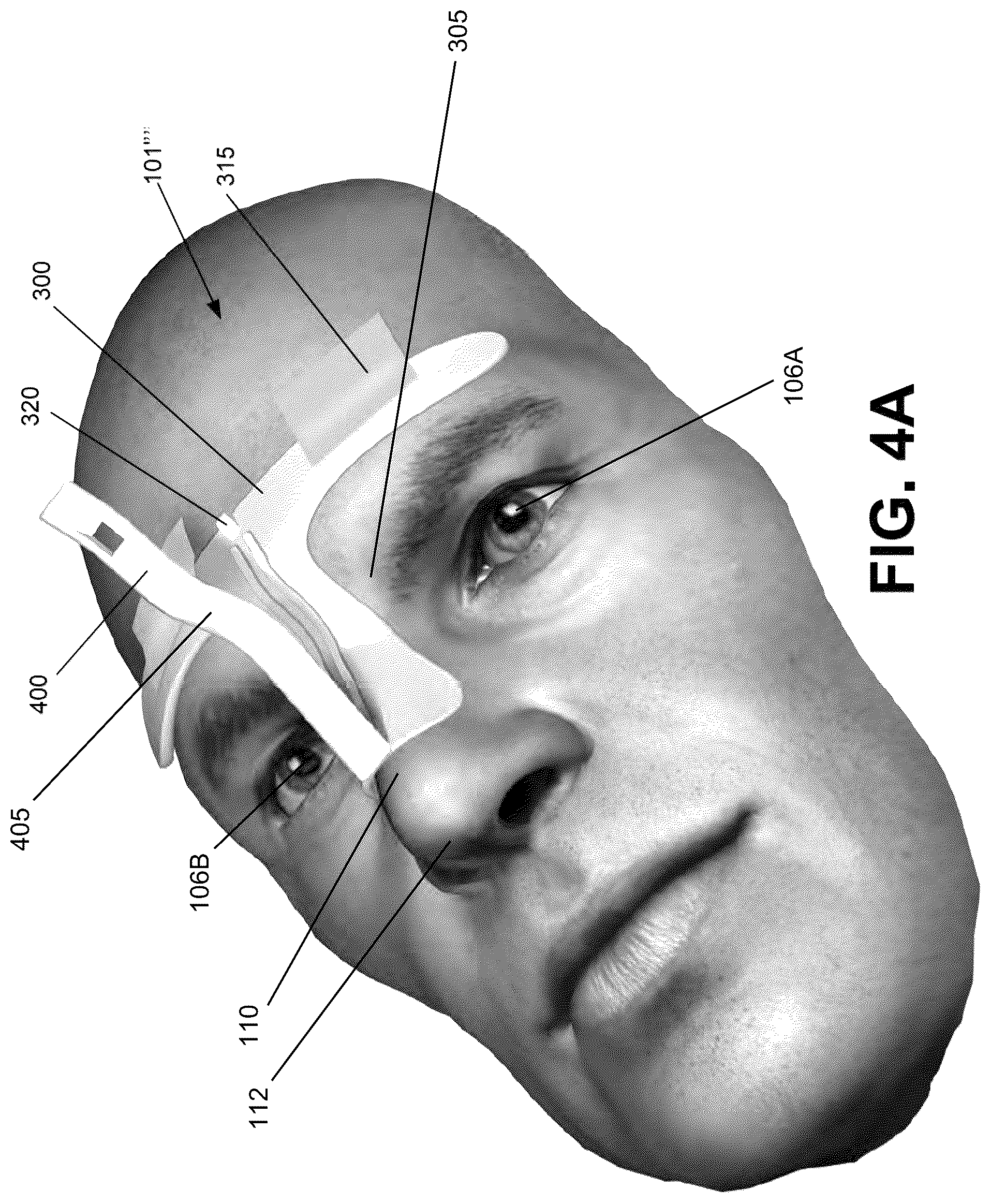 Patent US12303712 Figure 6 – Conformal system for therapeutic beta or low-energy gamma radiation shielding