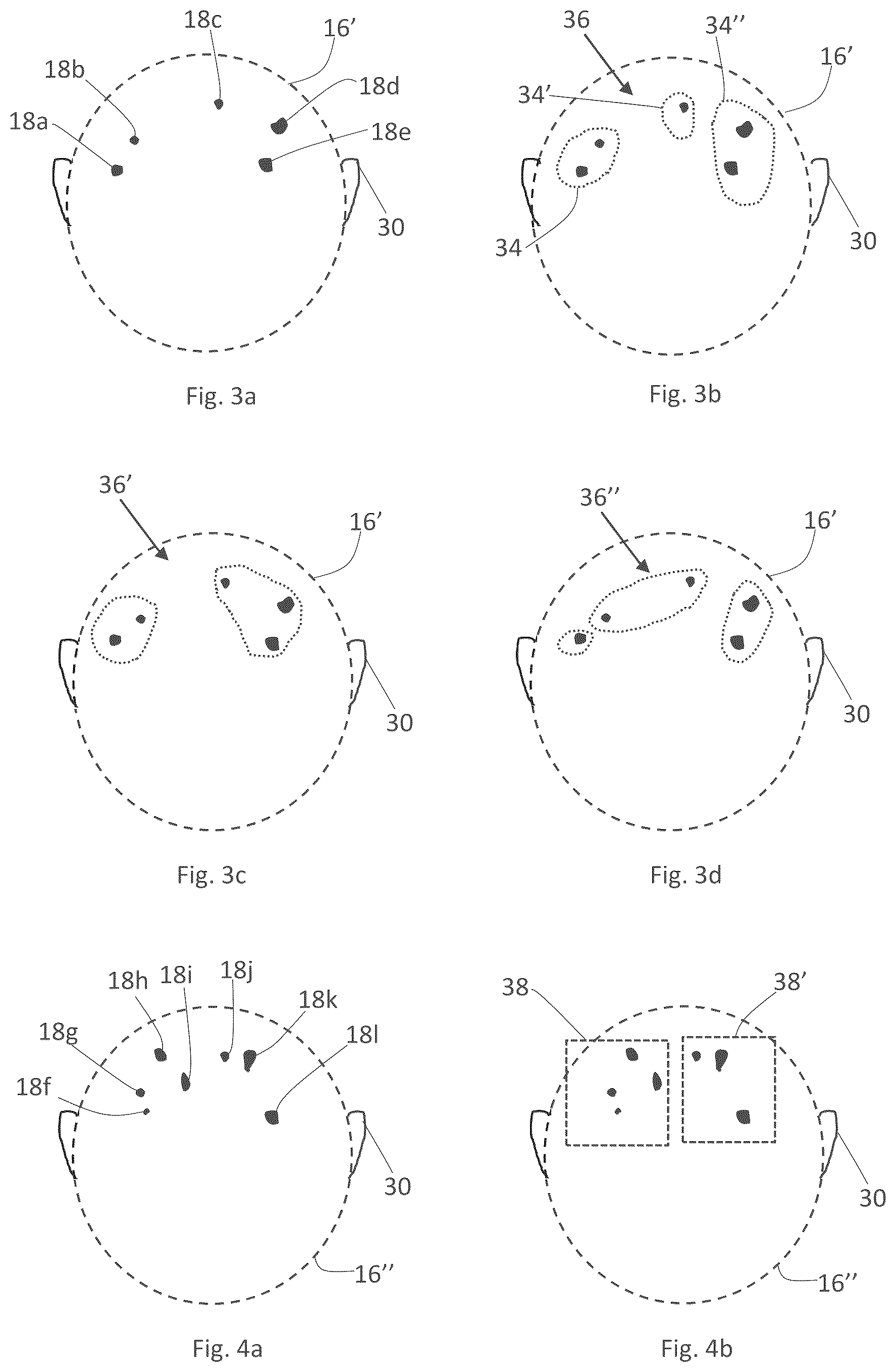 Patent US12303714 Figure 2 – System and method for automated radiotherapy treatment planning