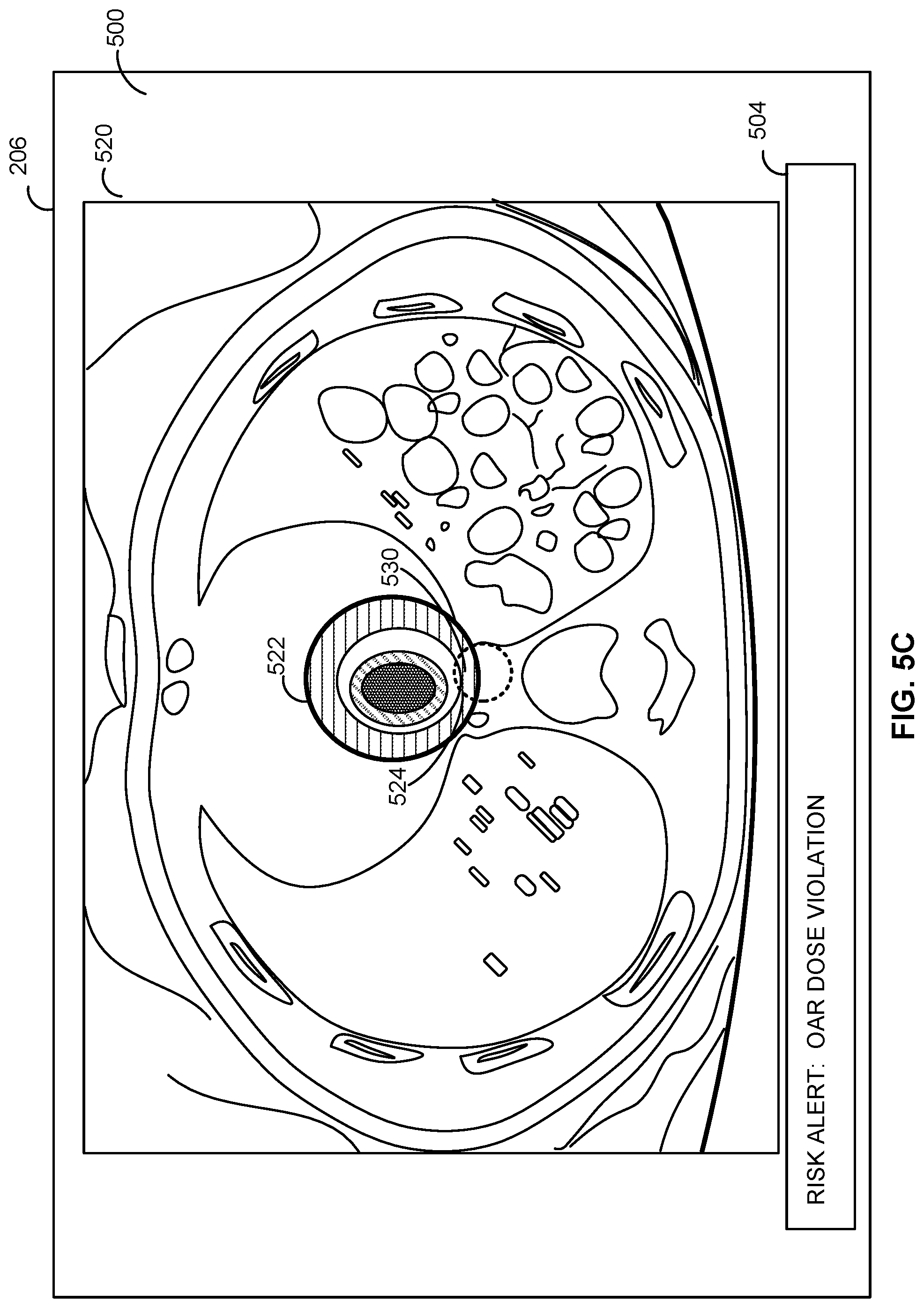 Patent US12303715 Figure 8 – Methods and apparatus for automatically determining radioablation treatment risk