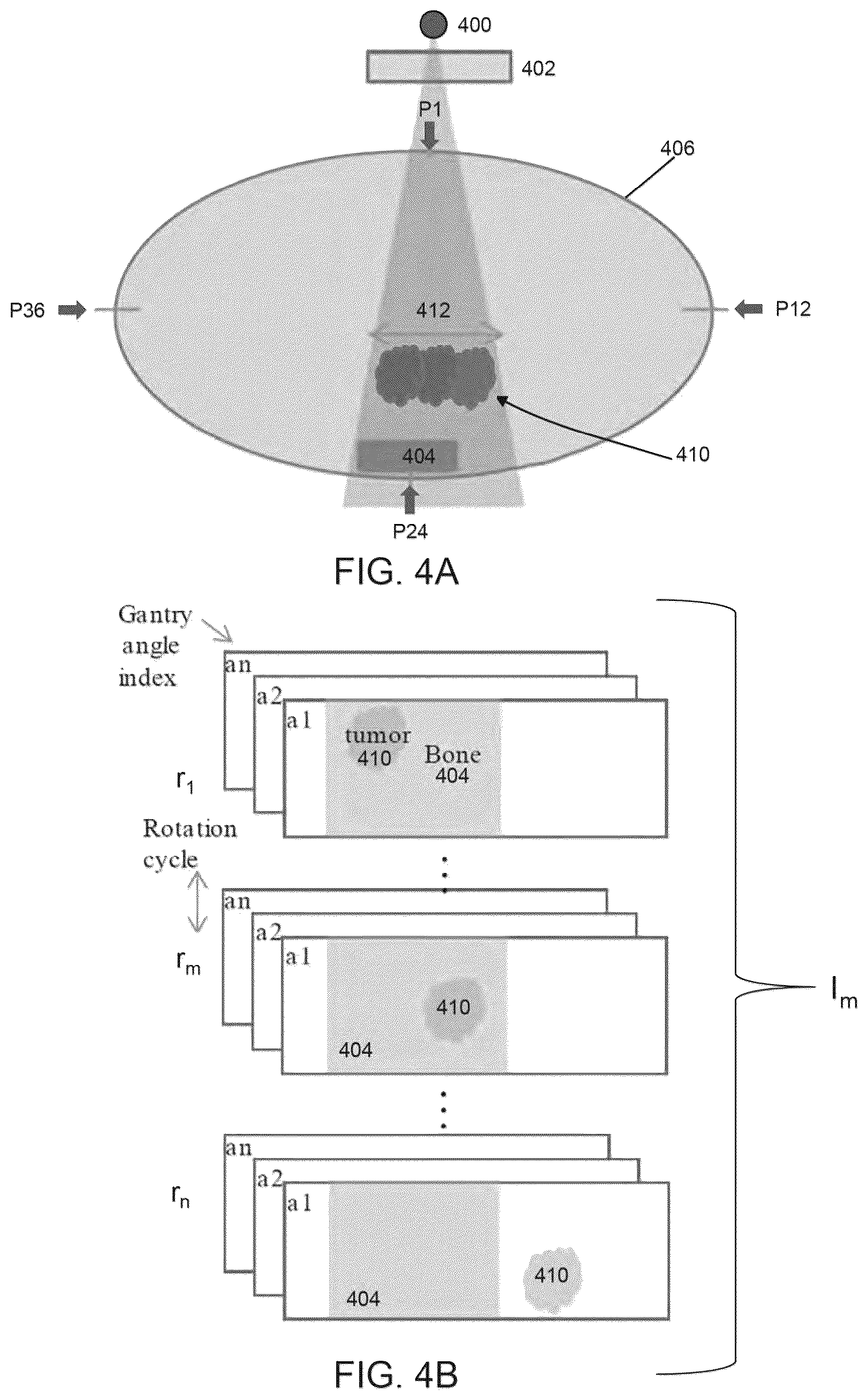 Patent US12303717 Figure 7 – Radiation therapy systems and methods with tumor tracking