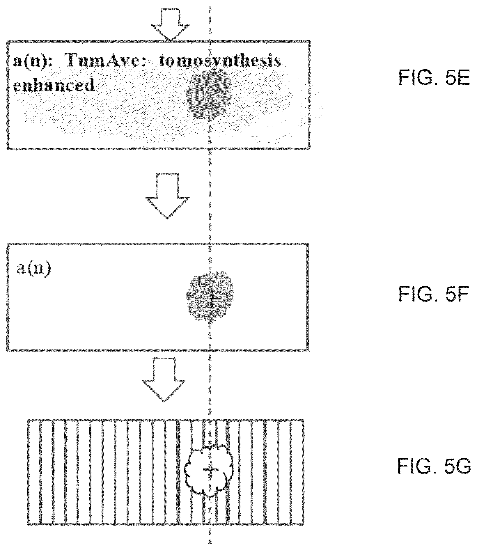 Patent US12303717 Figure 12 – Radiation therapy systems and methods with tumor tracking