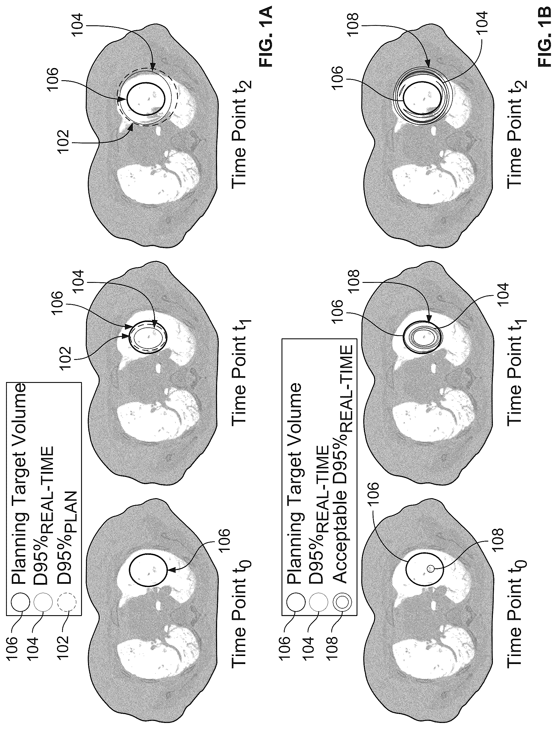 Patent US12303718 Figure 1 – Graphical representation of radiation therapy
