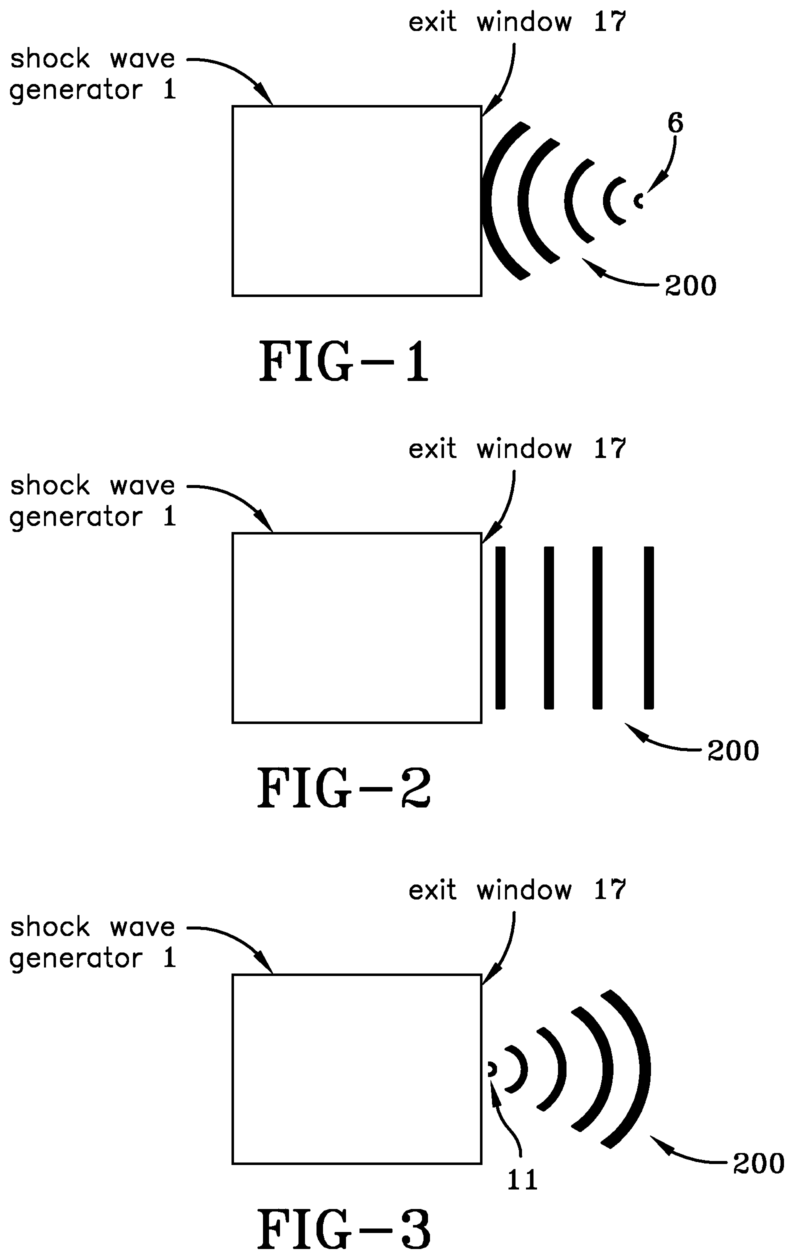 Patent US12303721 — Acoustic shock wave treatment and devices for appendages — Figure 1