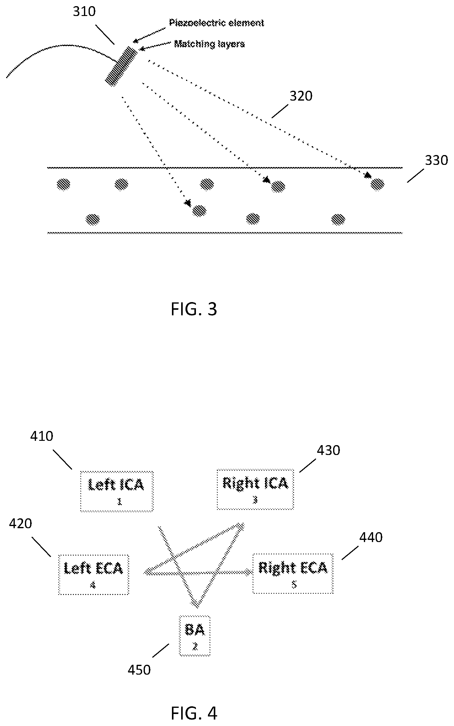 Patent US12303722 Figure 2 – Ultrasound system, apparatus, and method for transcranial treatment